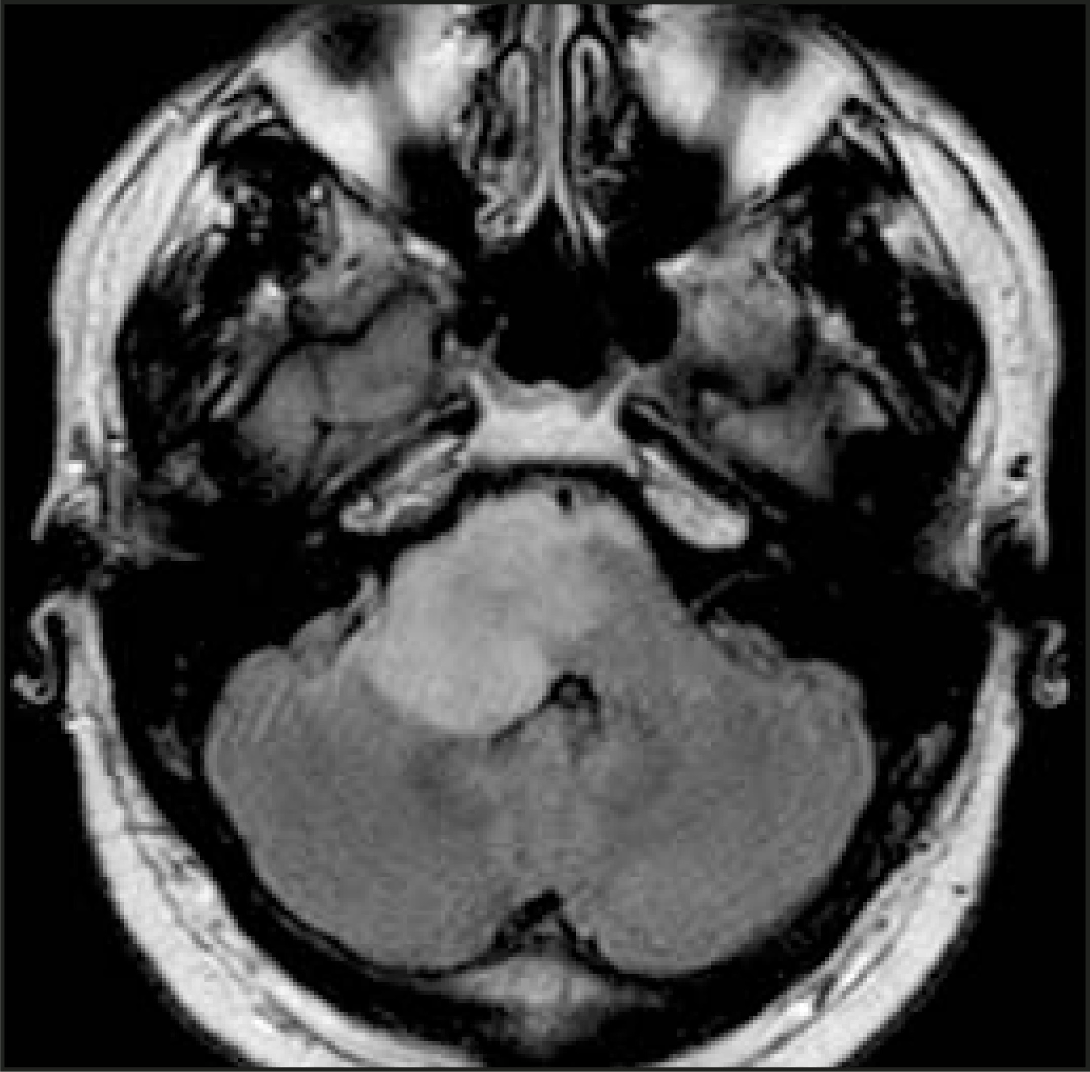 FIGURE 17.