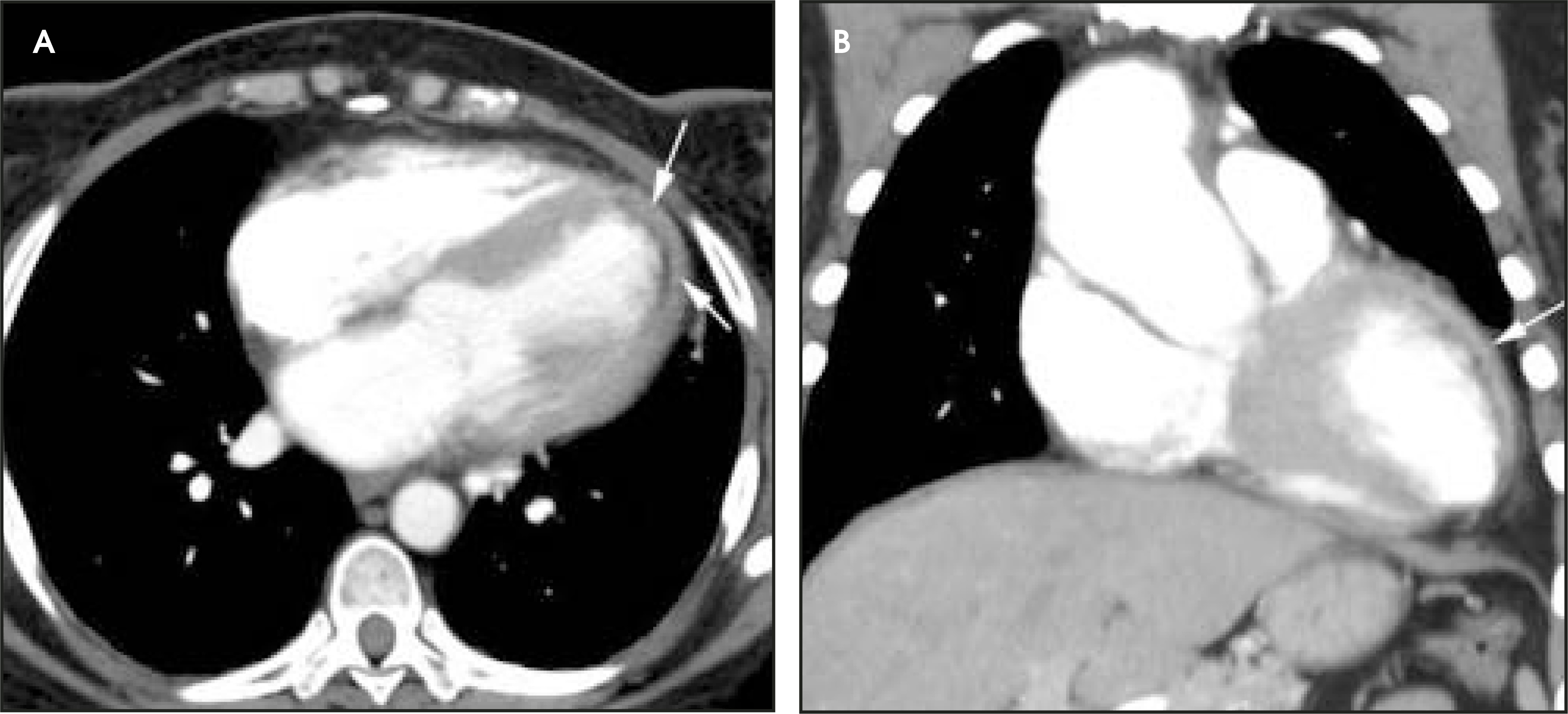 FIGURE 11.