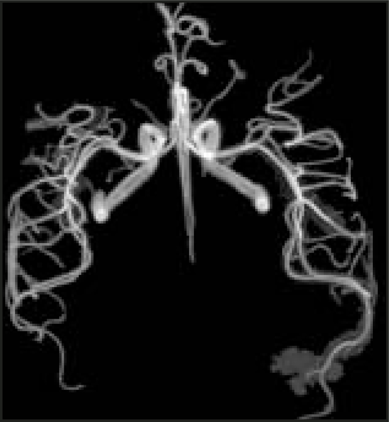FIGURE 14.