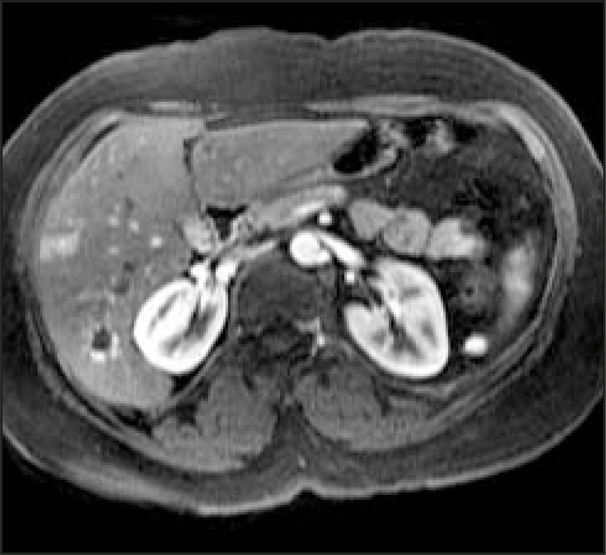 FIGURE 17.