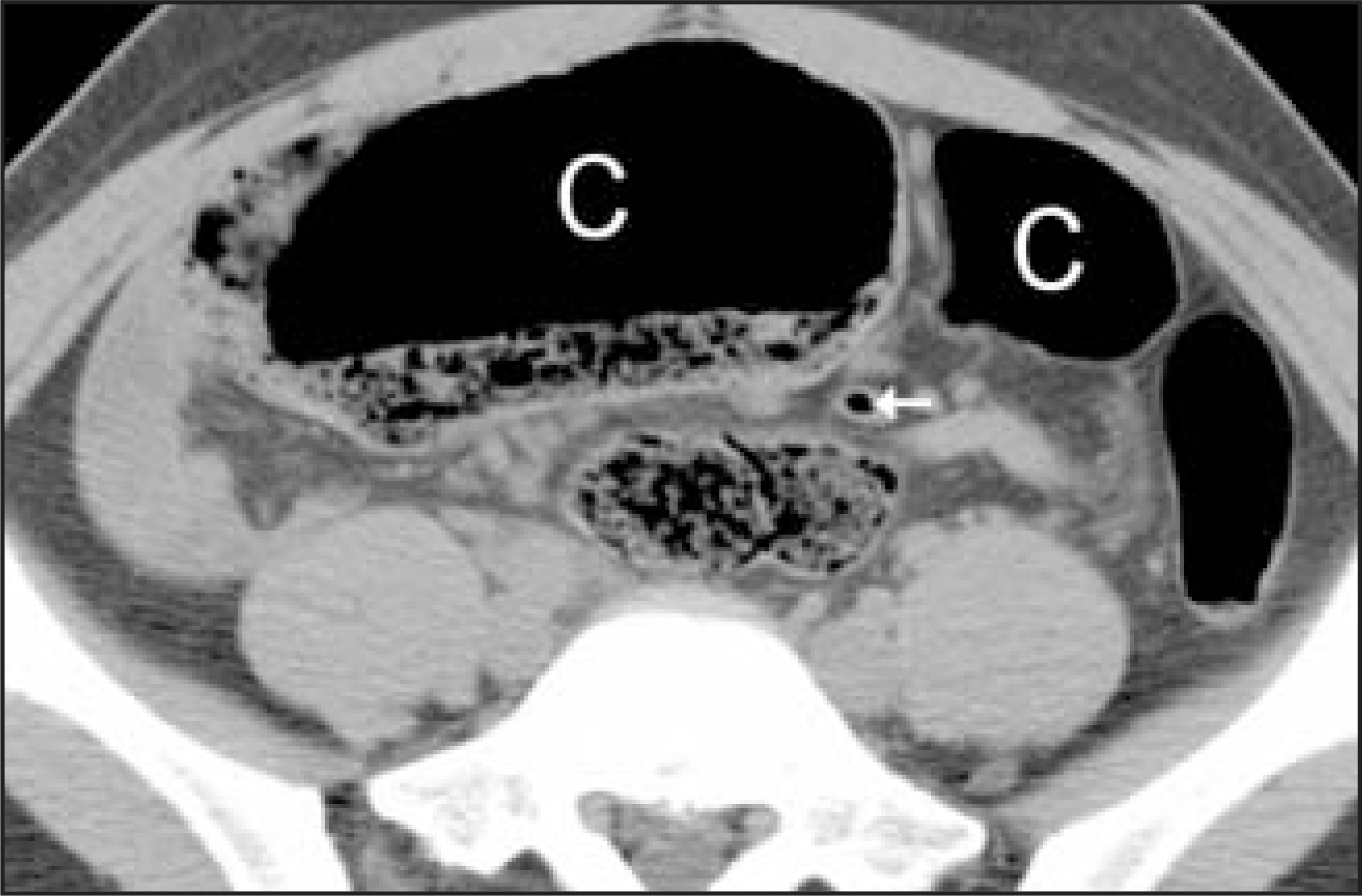 FIGURE 11.