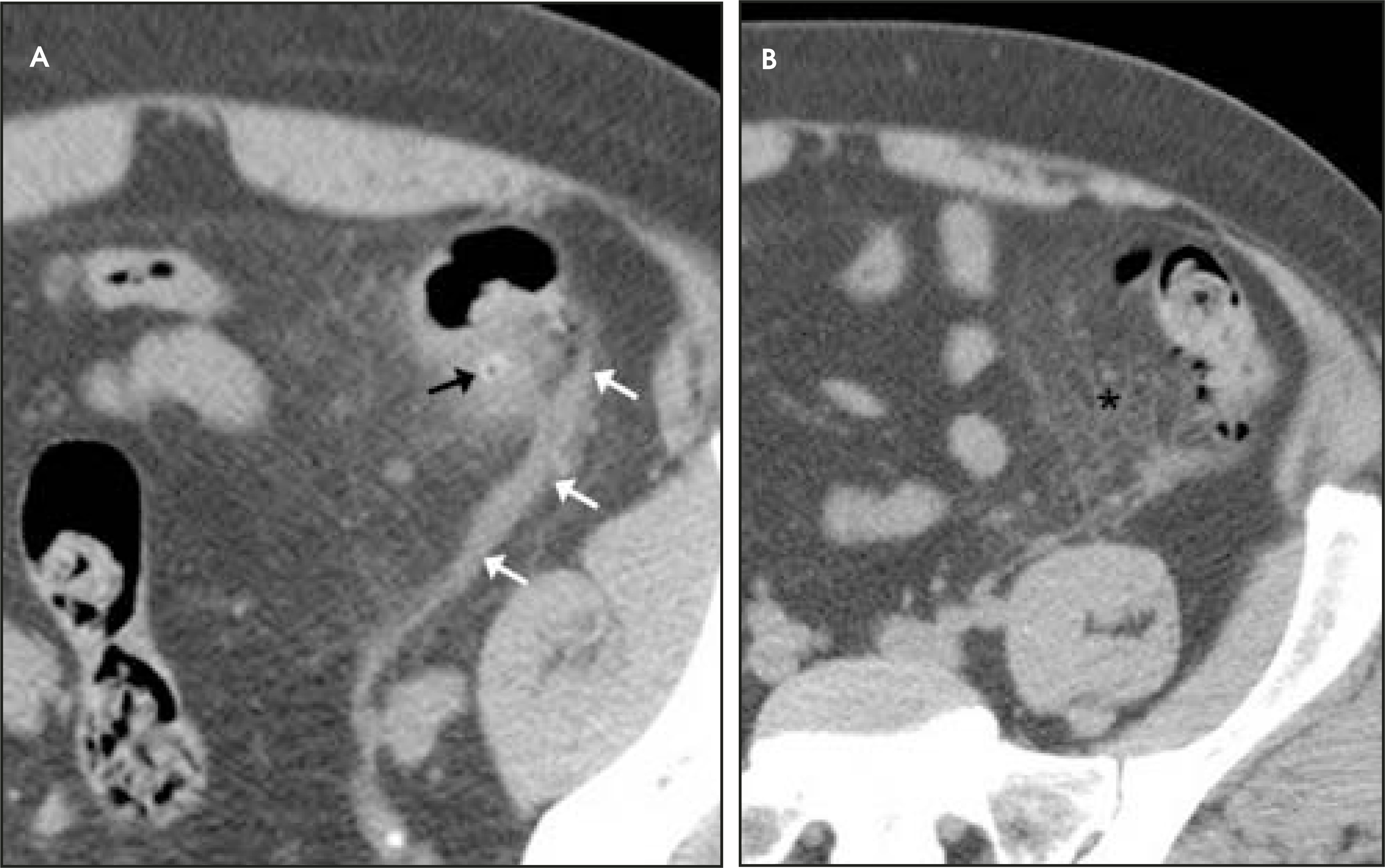 FIGURE 13.