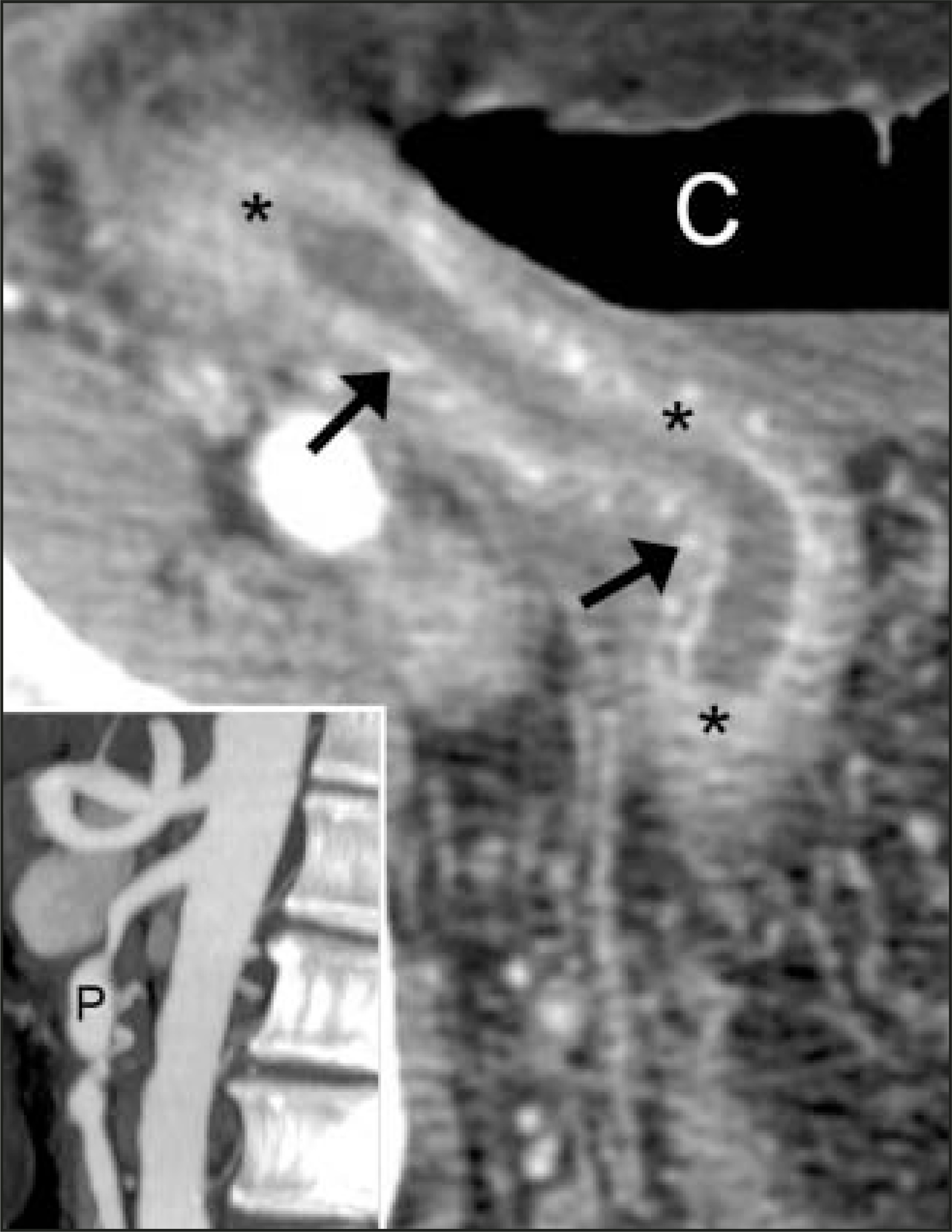 FIGURE 14.