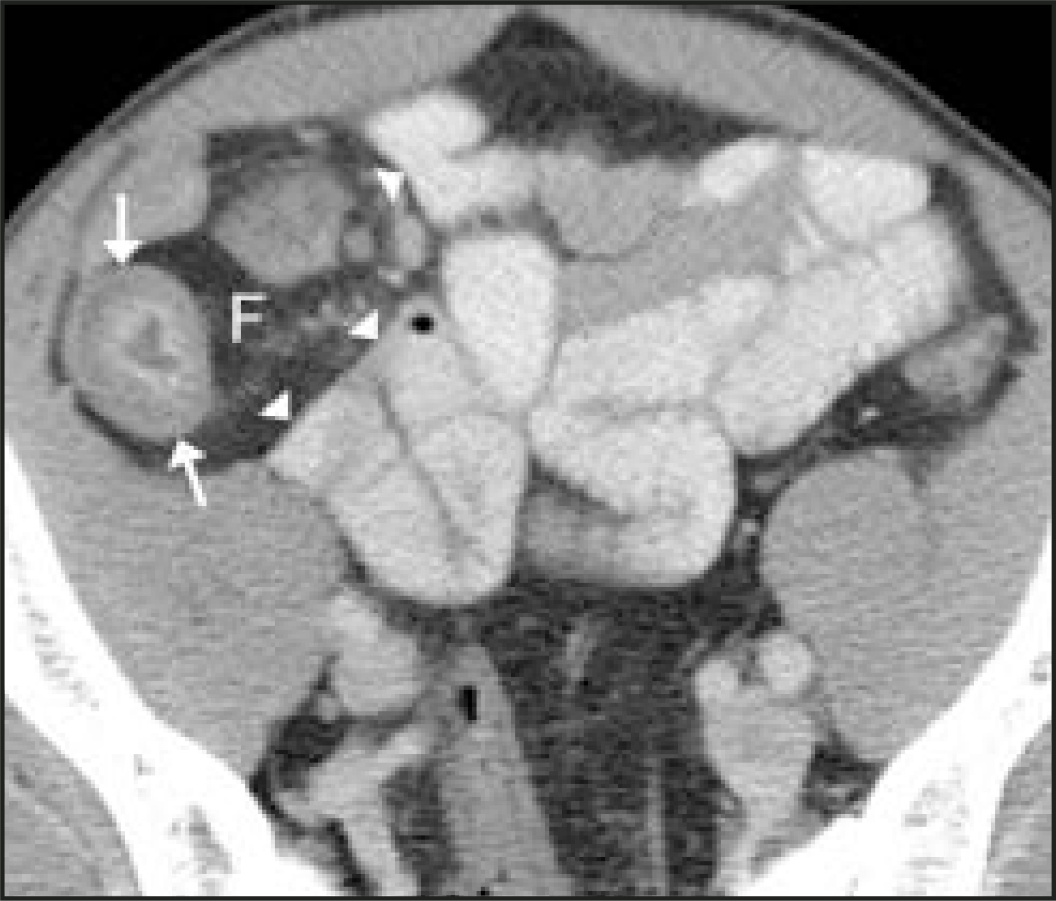 FIGURE 16.