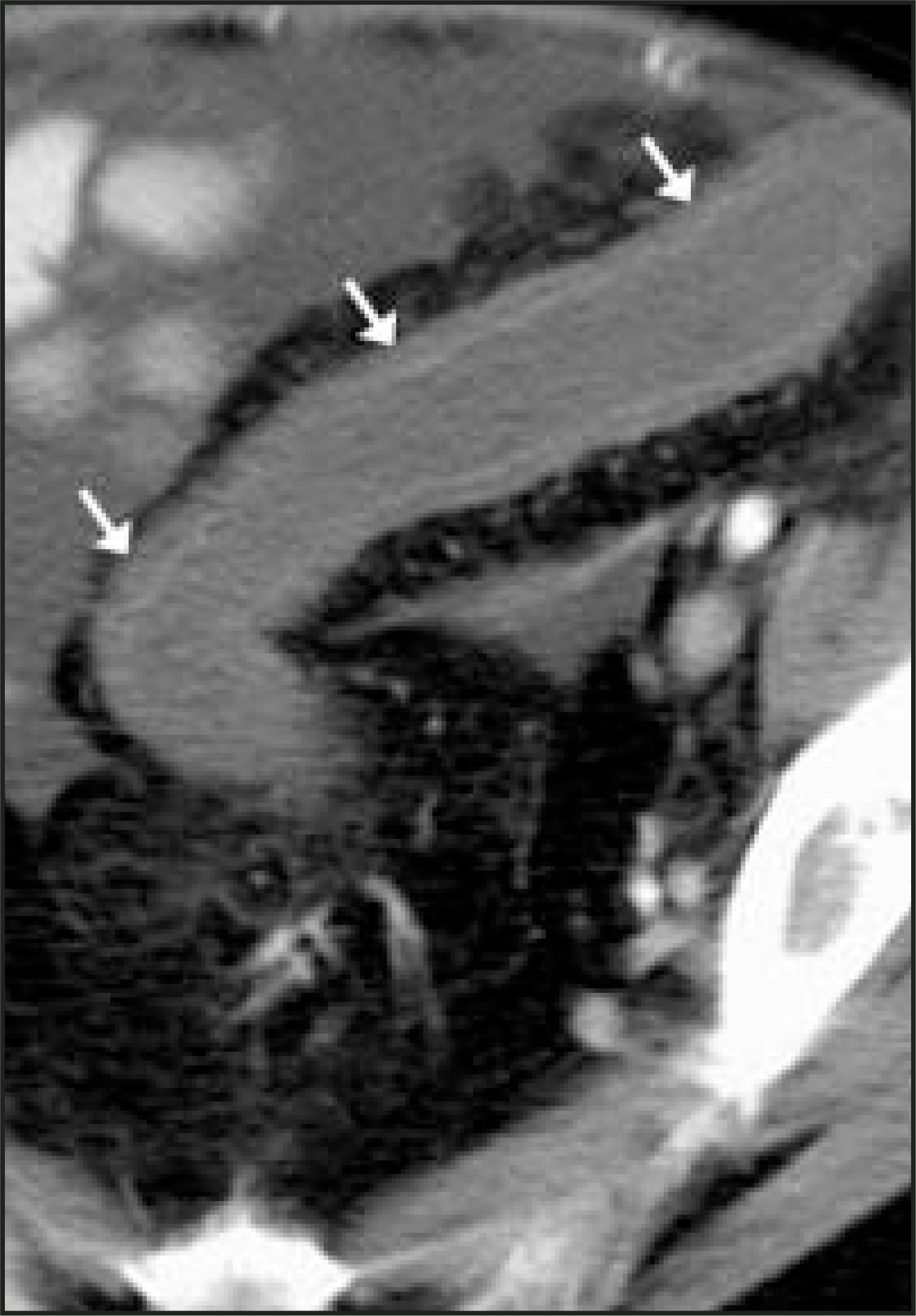 FIGURE 17.