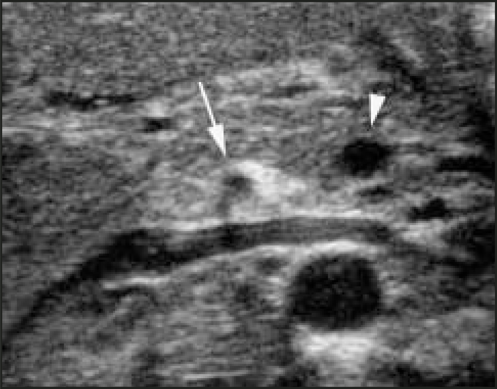 FIGURE 4.