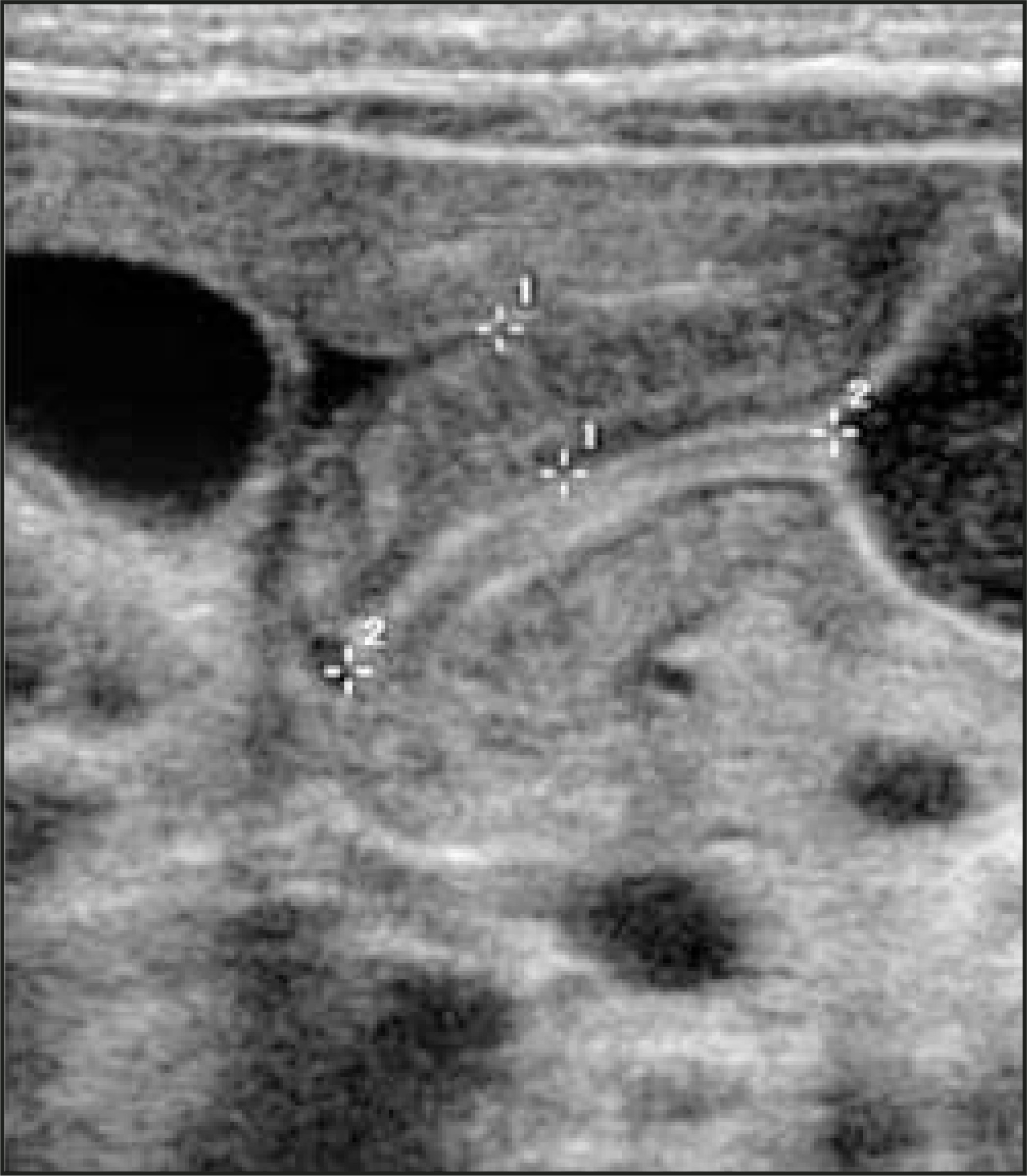 FIGURE 11.