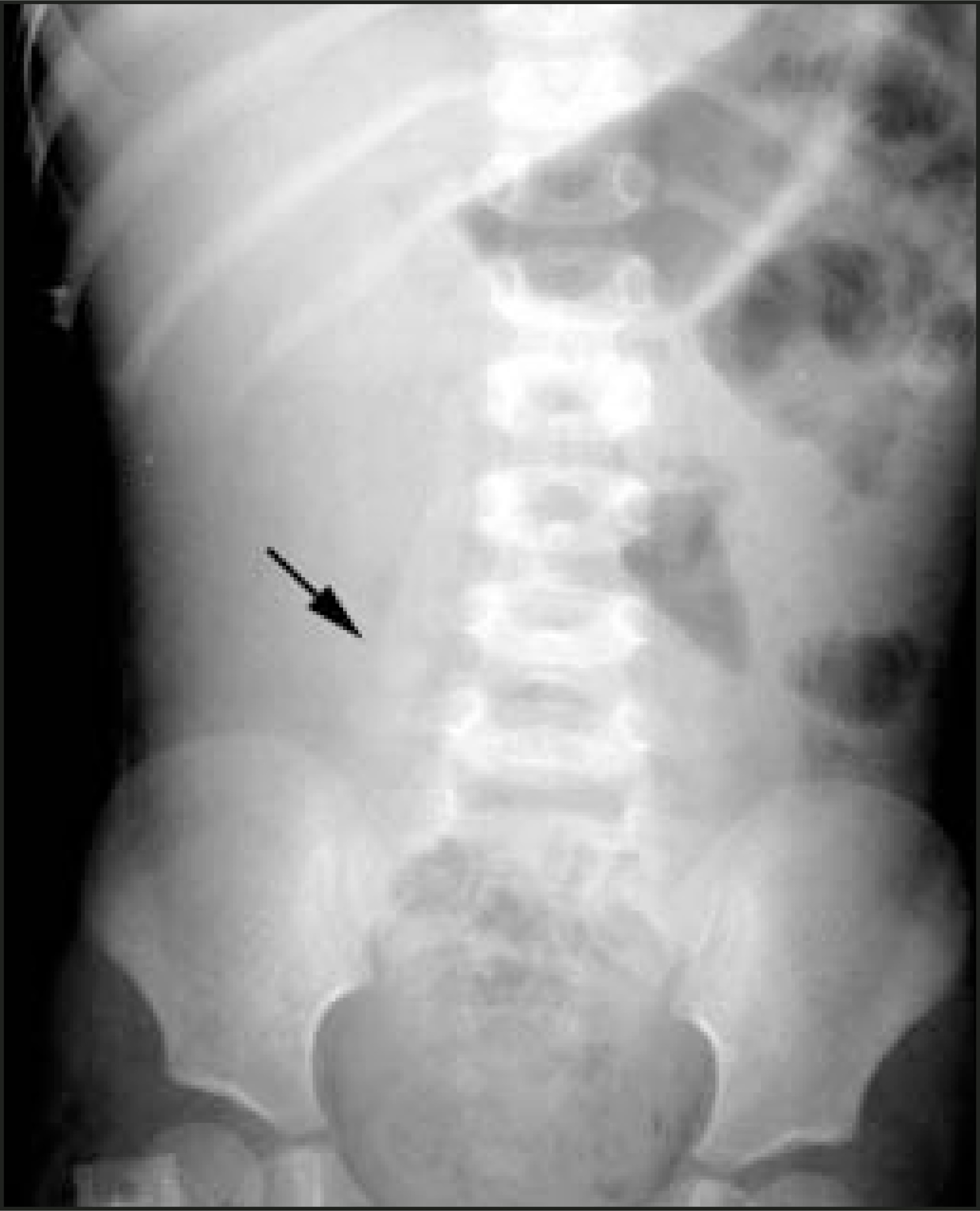 FIGURE 13.