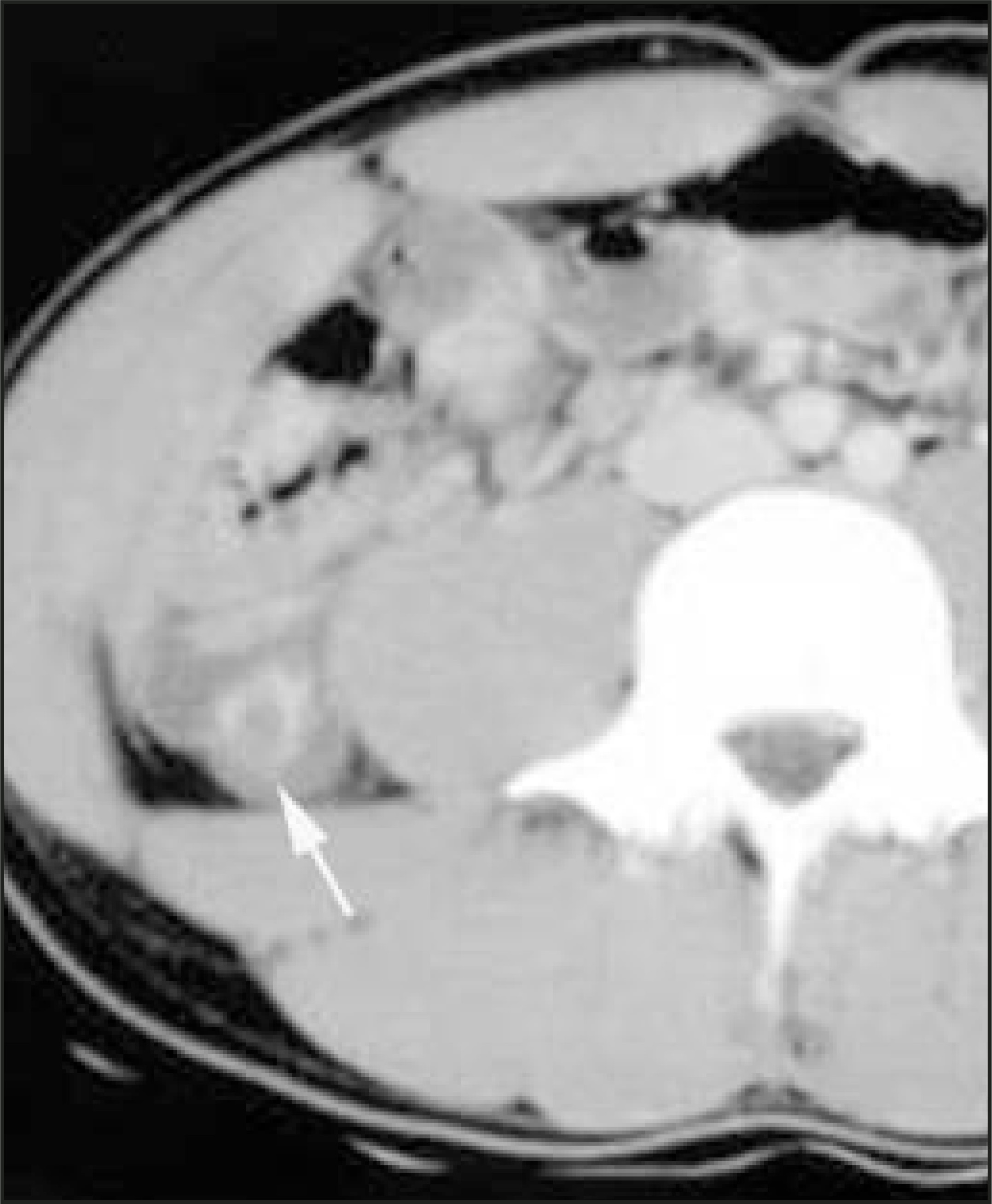 FIGURE 15.