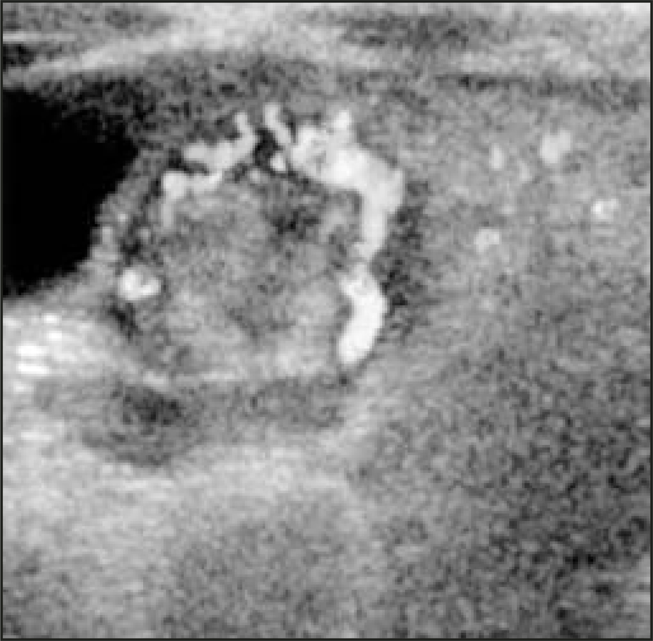 FIGURE 17.