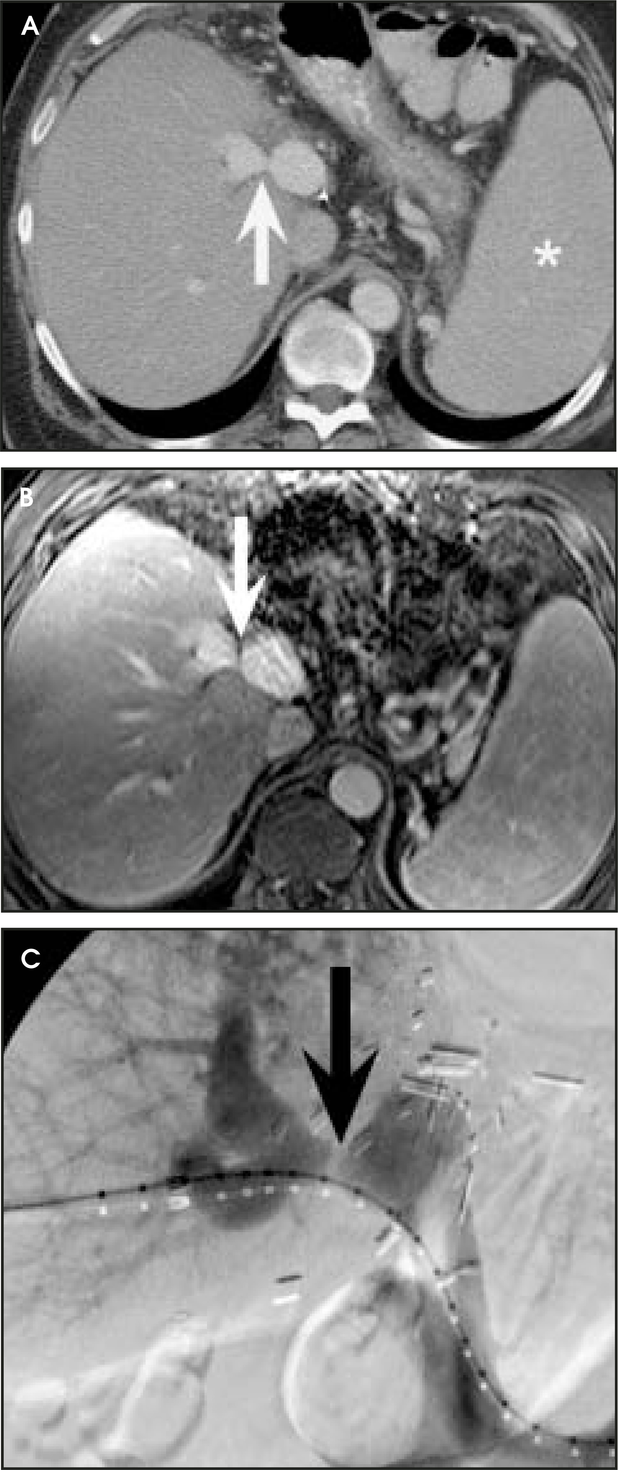 FIGURE 11.
