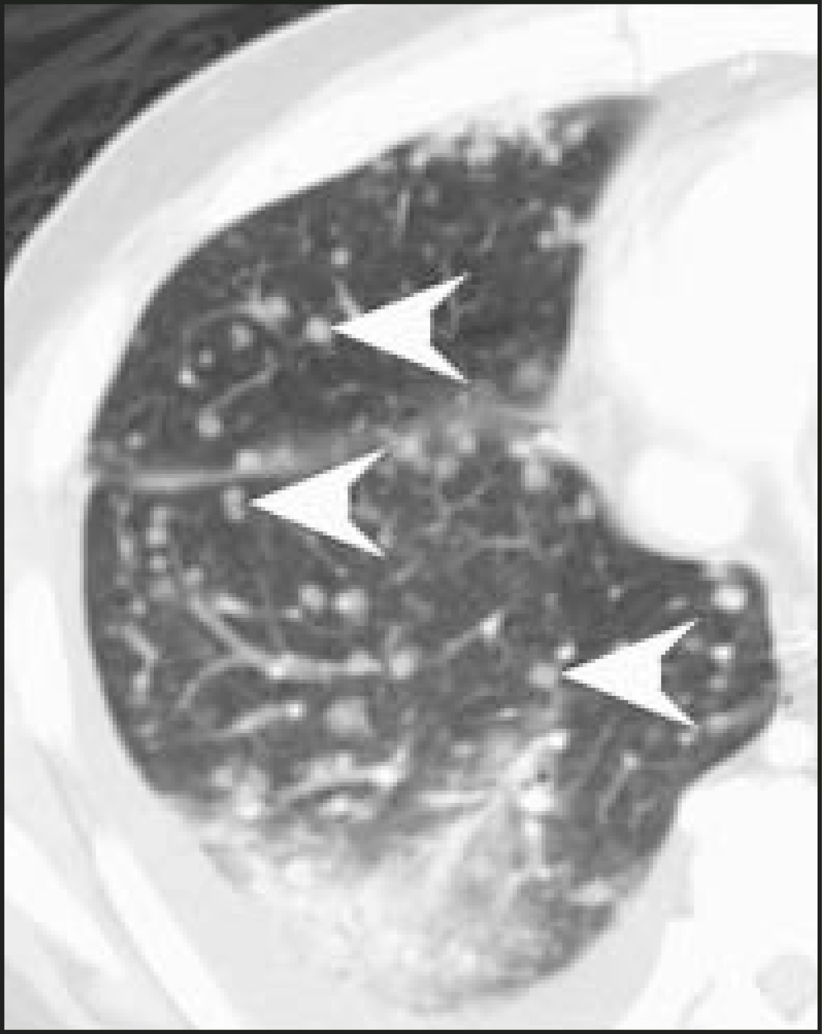 FIGURE 12.