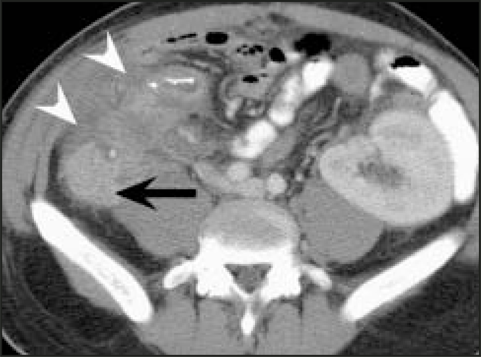 FIGURE 14.