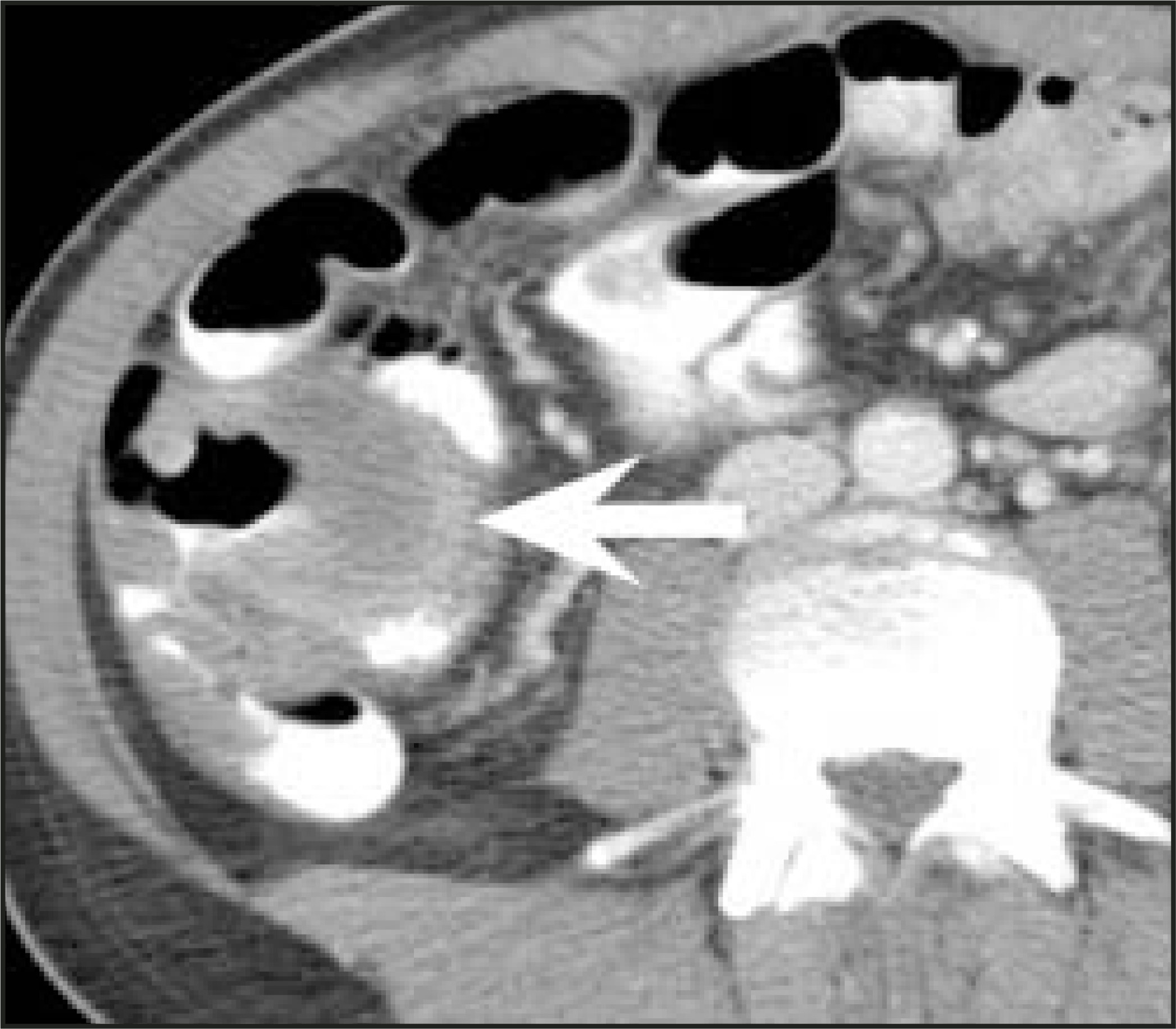 FIGURE 16.