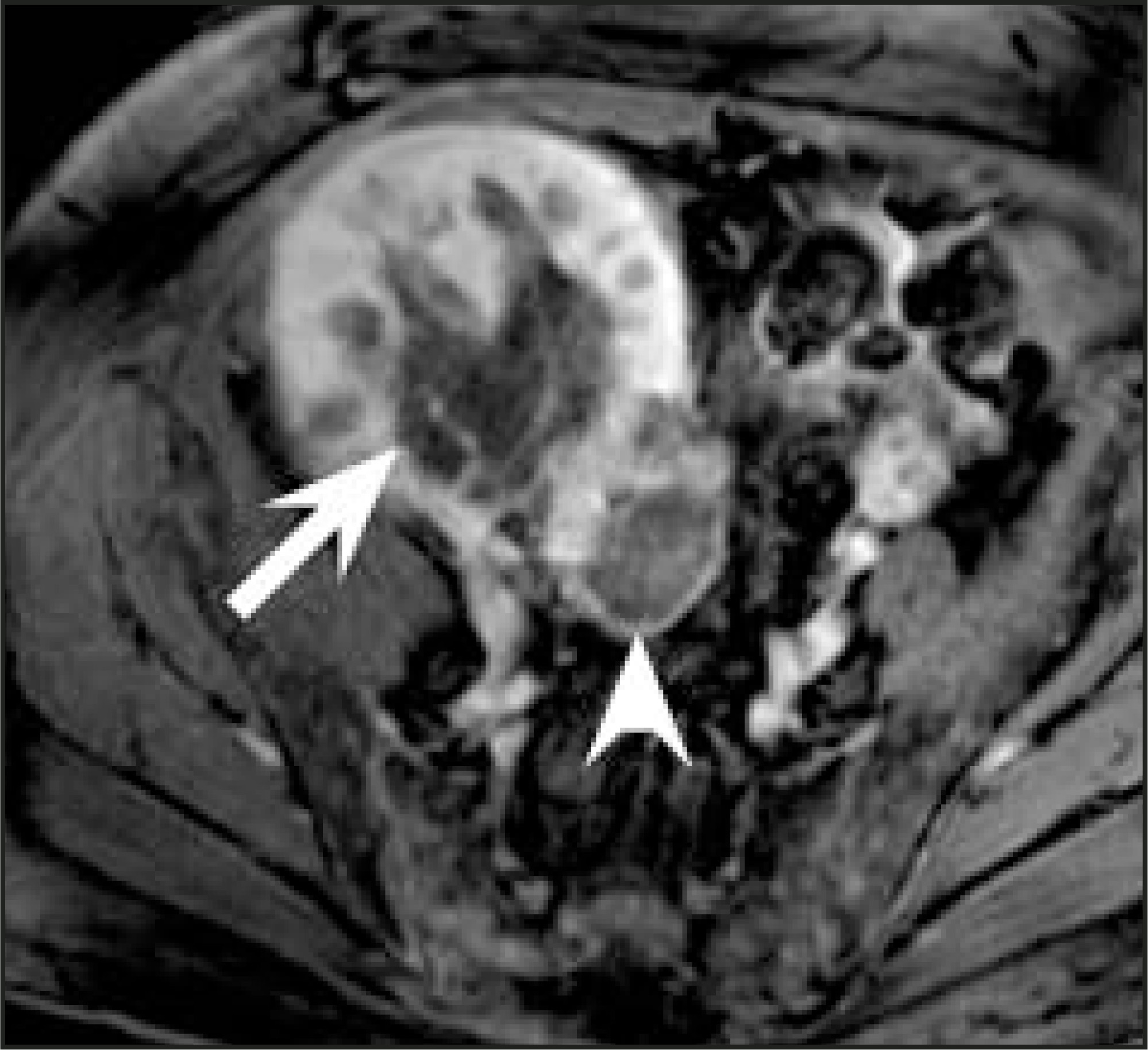 FIGURE 17.