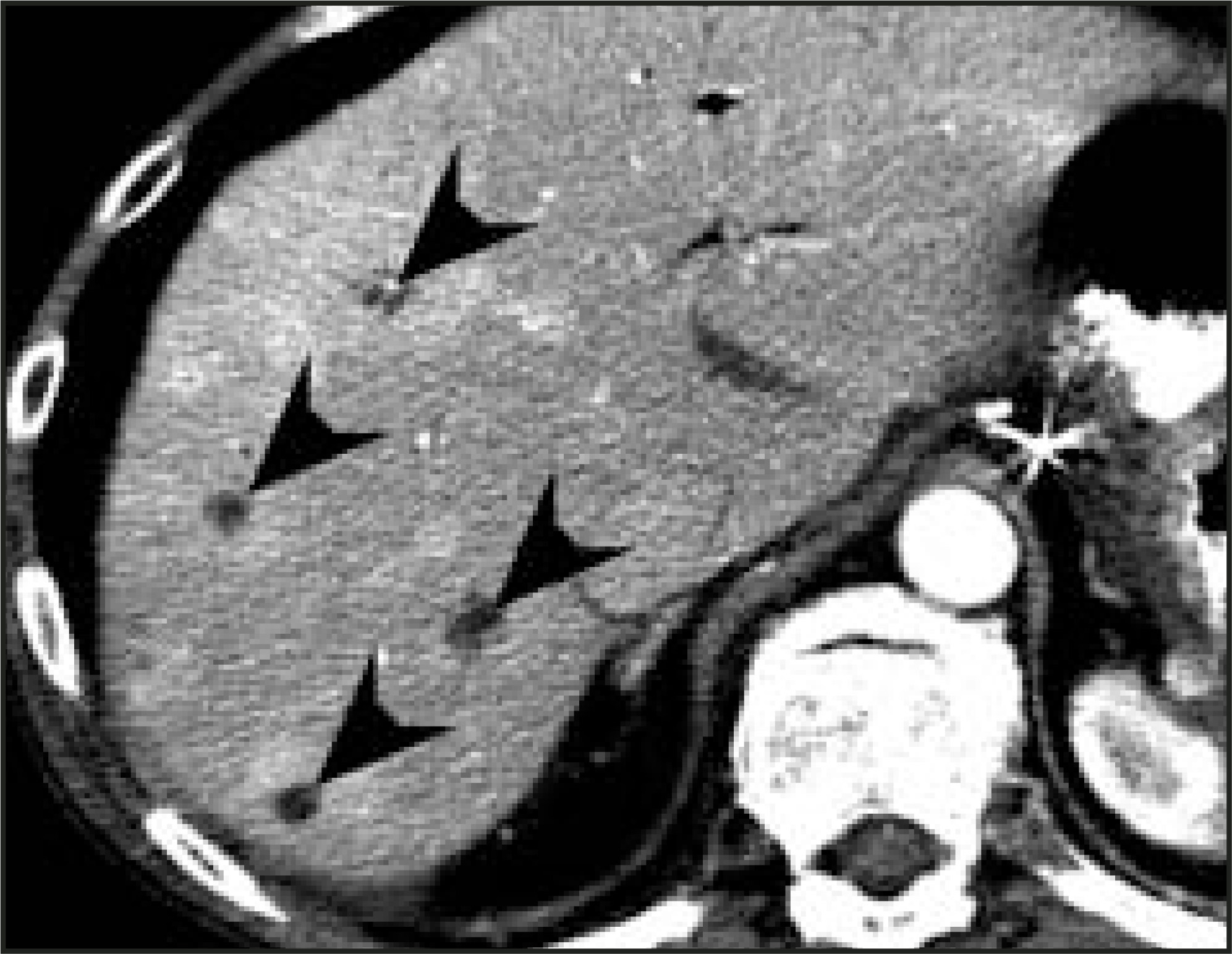 FIGURE 19.