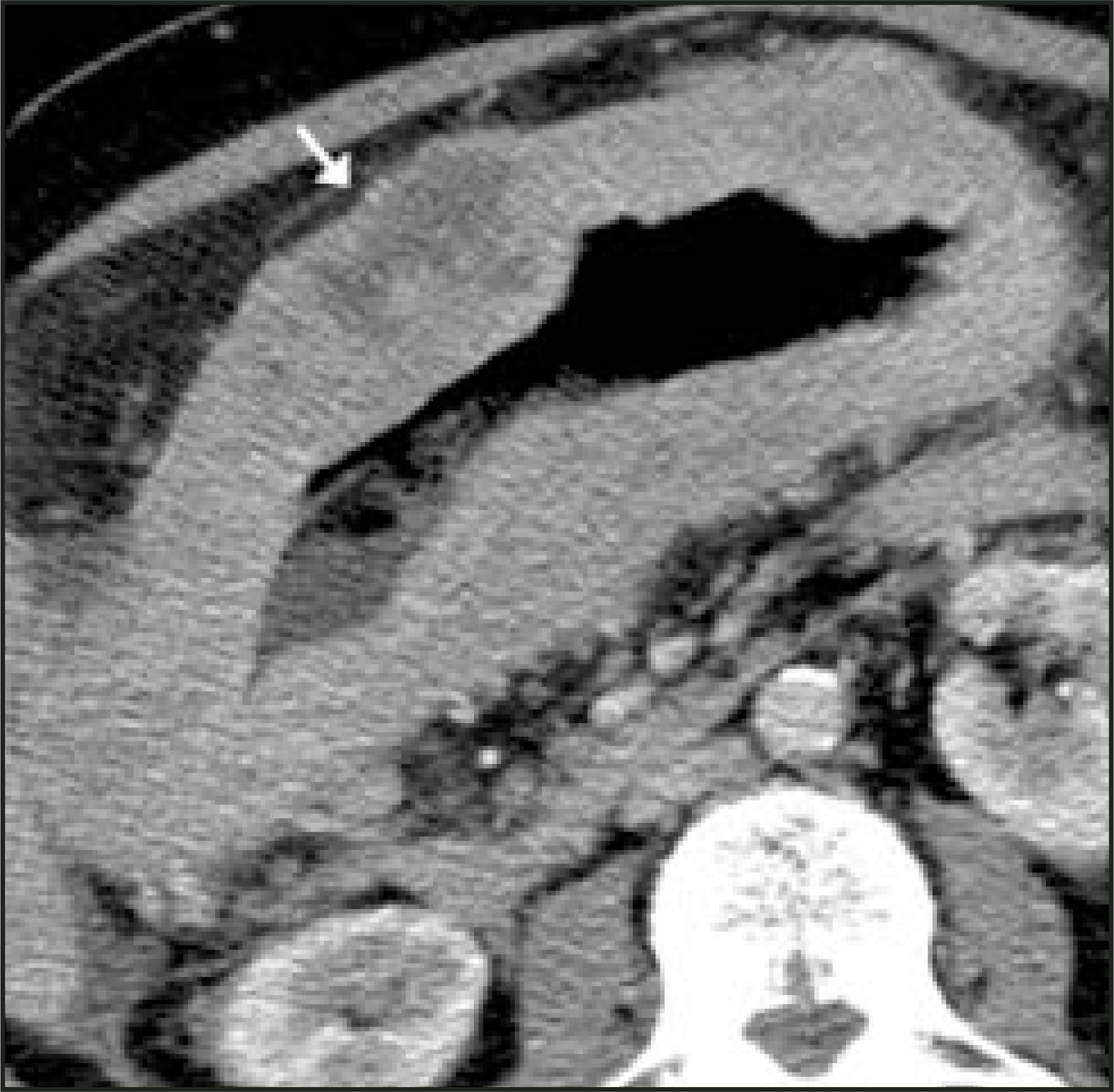 FIGURE 10.