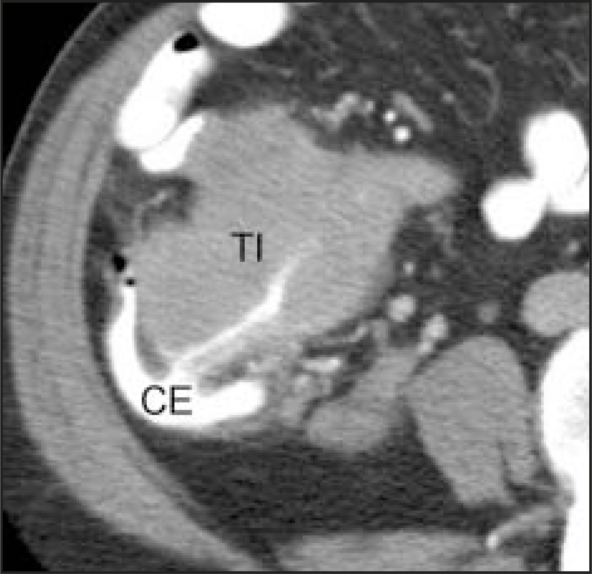FIGURE 11.