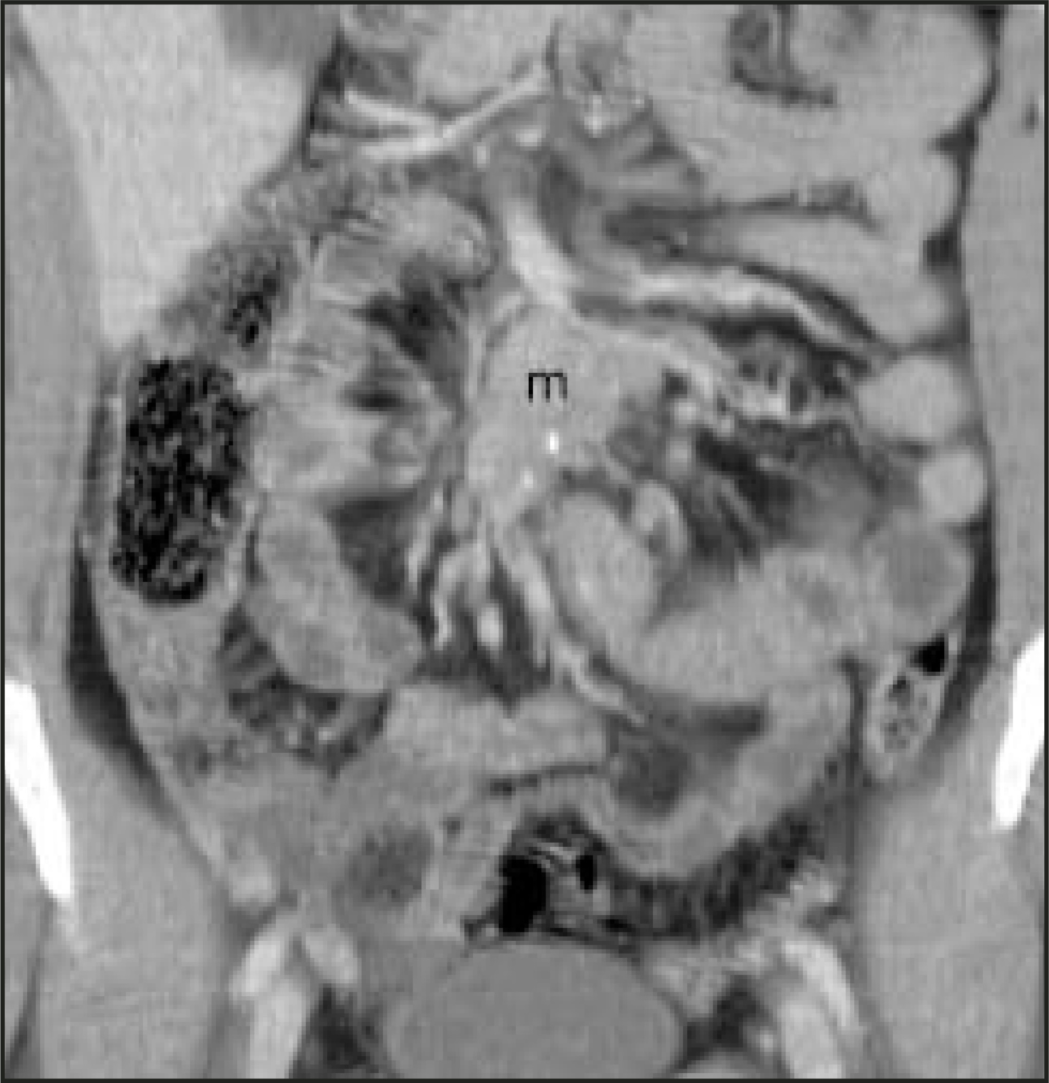 FIGURE 13.