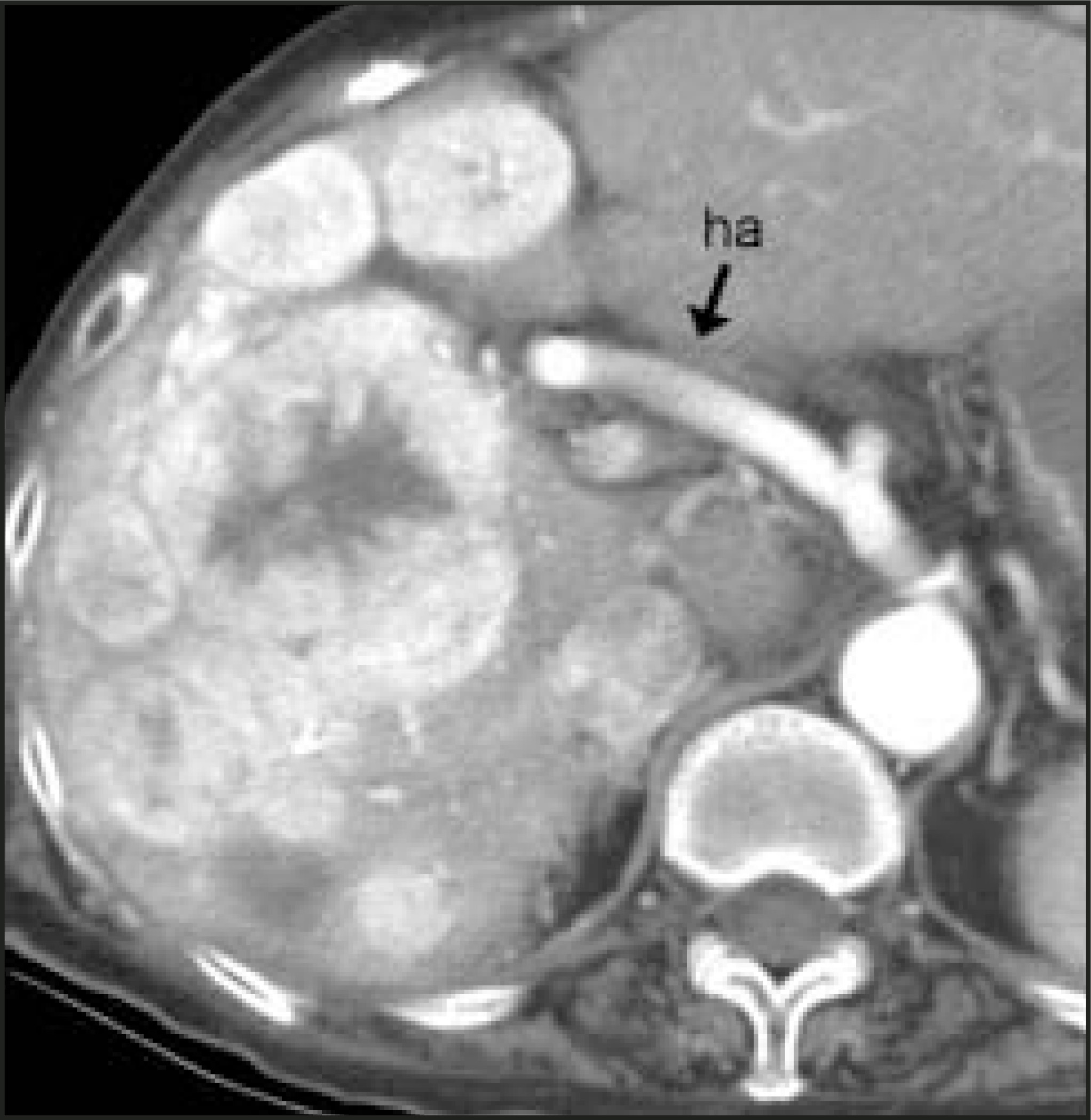 FIGURE 14.