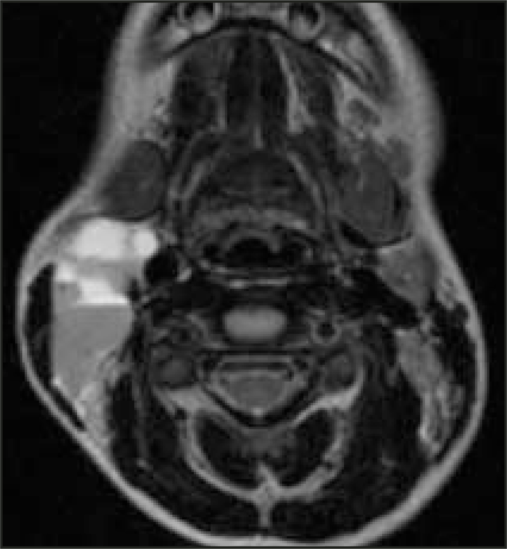 FIGURE 11.