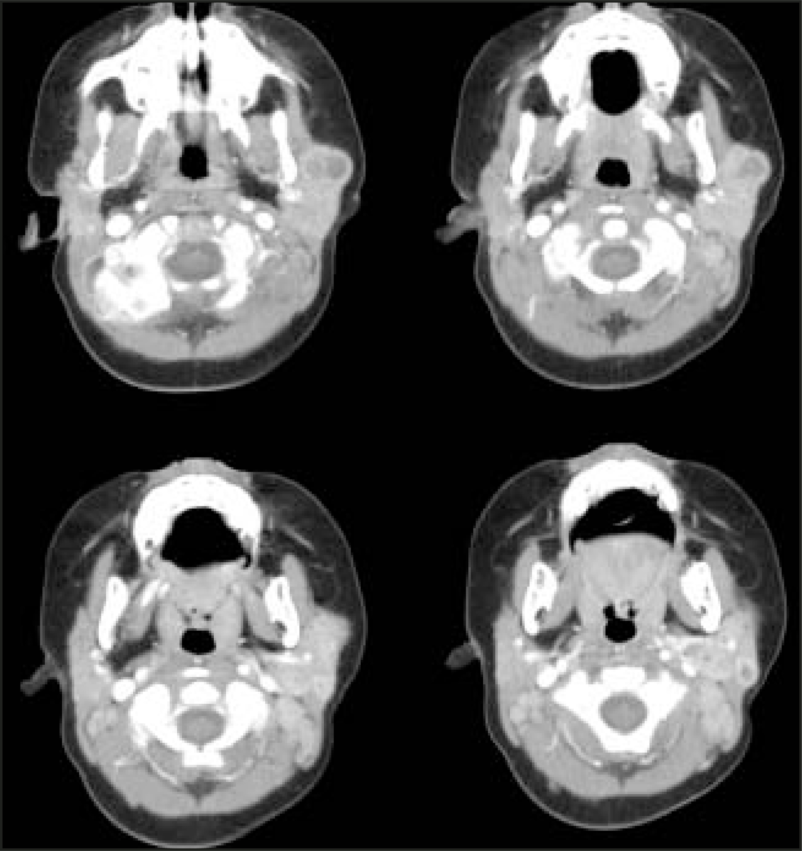 FIGURE 14.