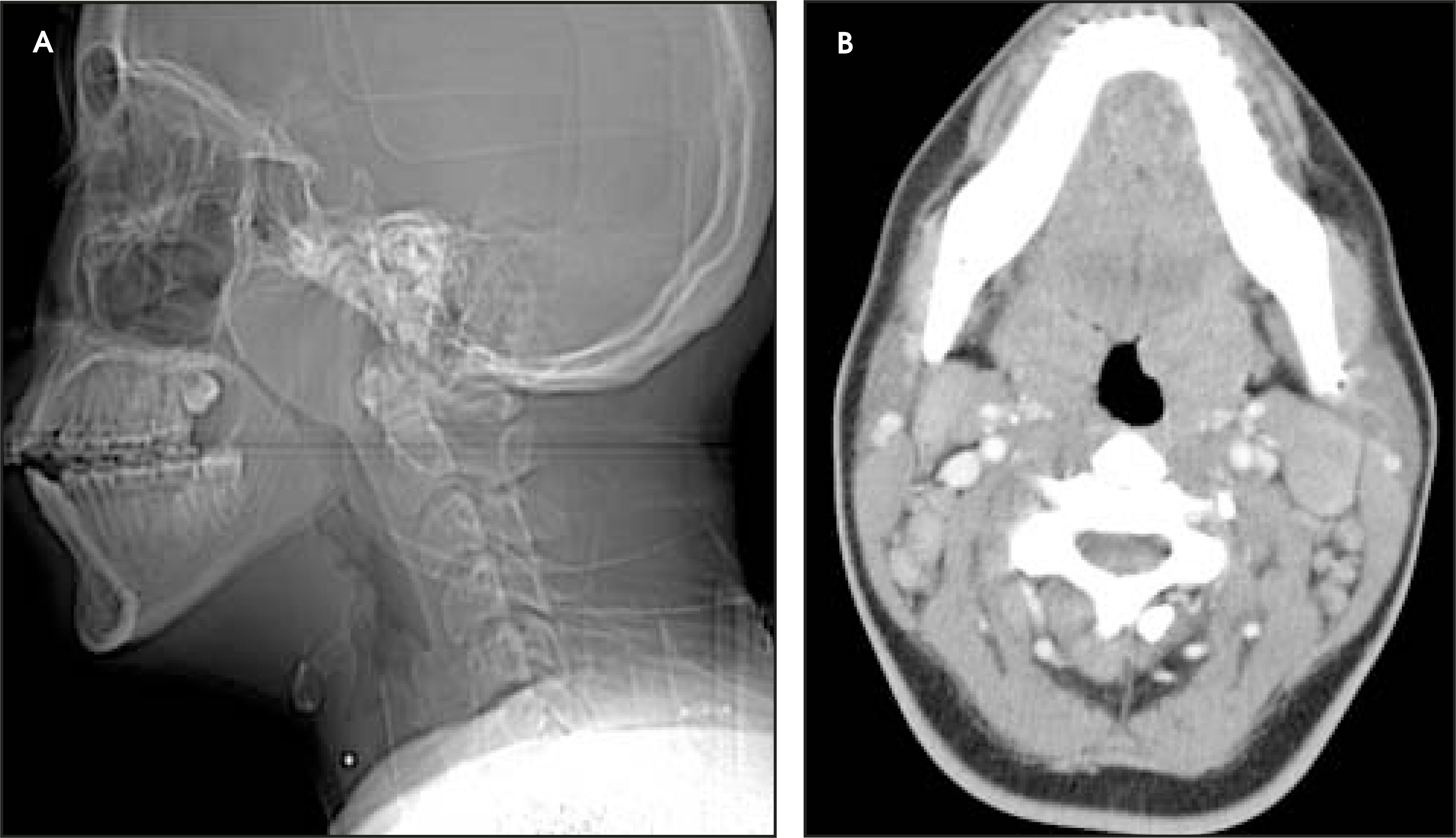 FIGURE 16.
