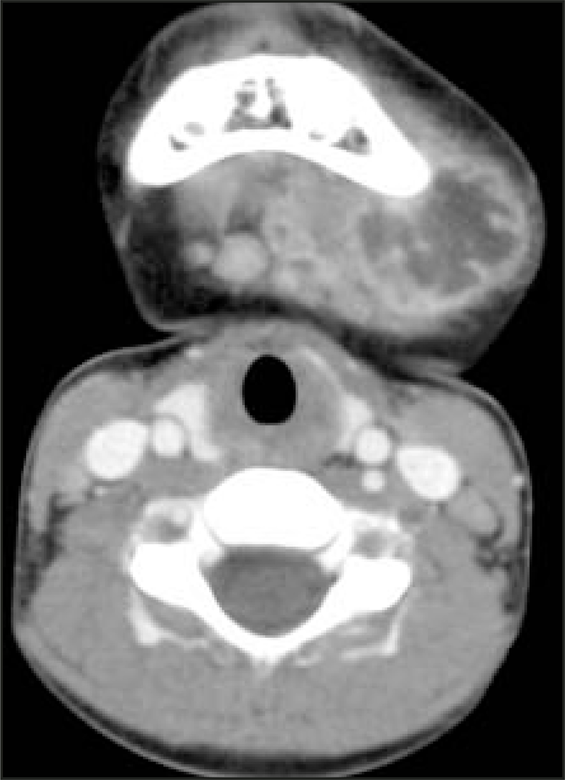 FIGURE 17.
