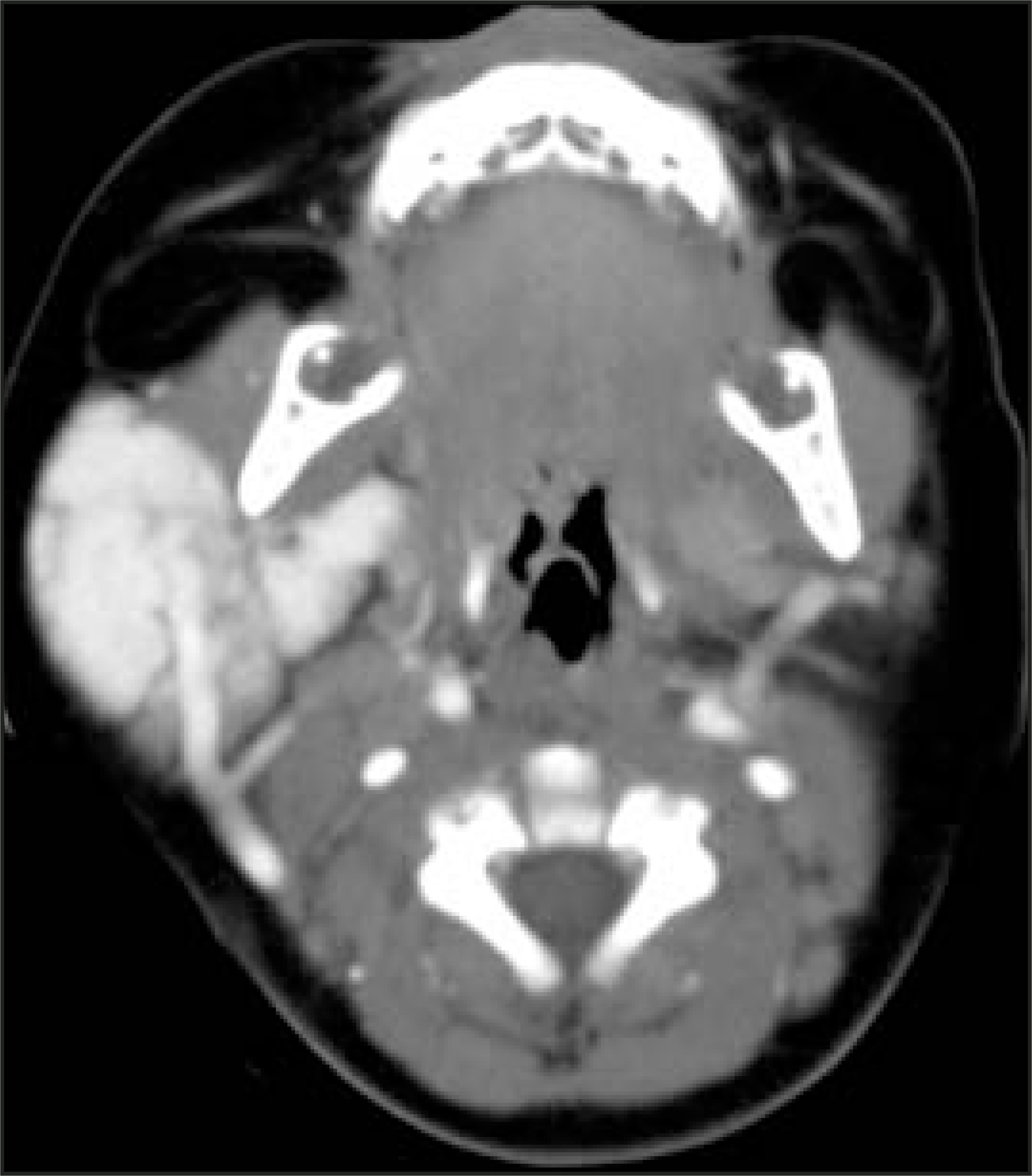 FIGURE 18.