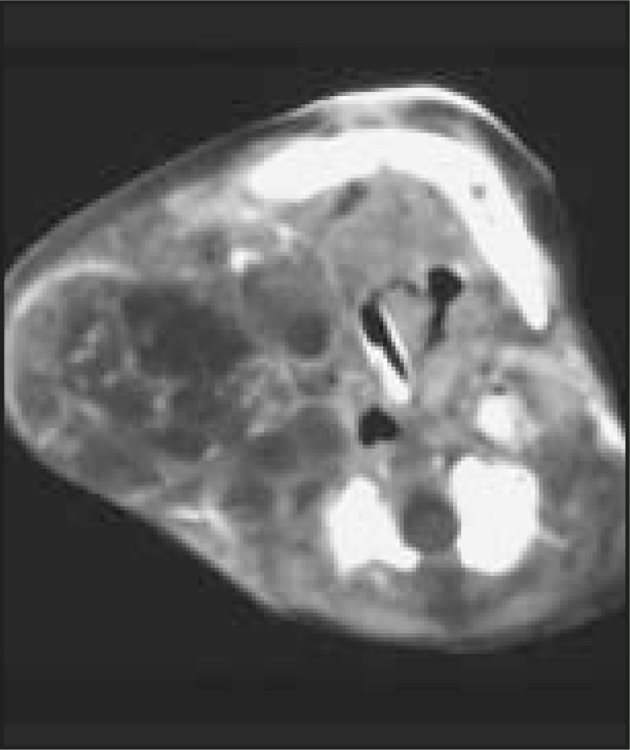 FIGURE 21.