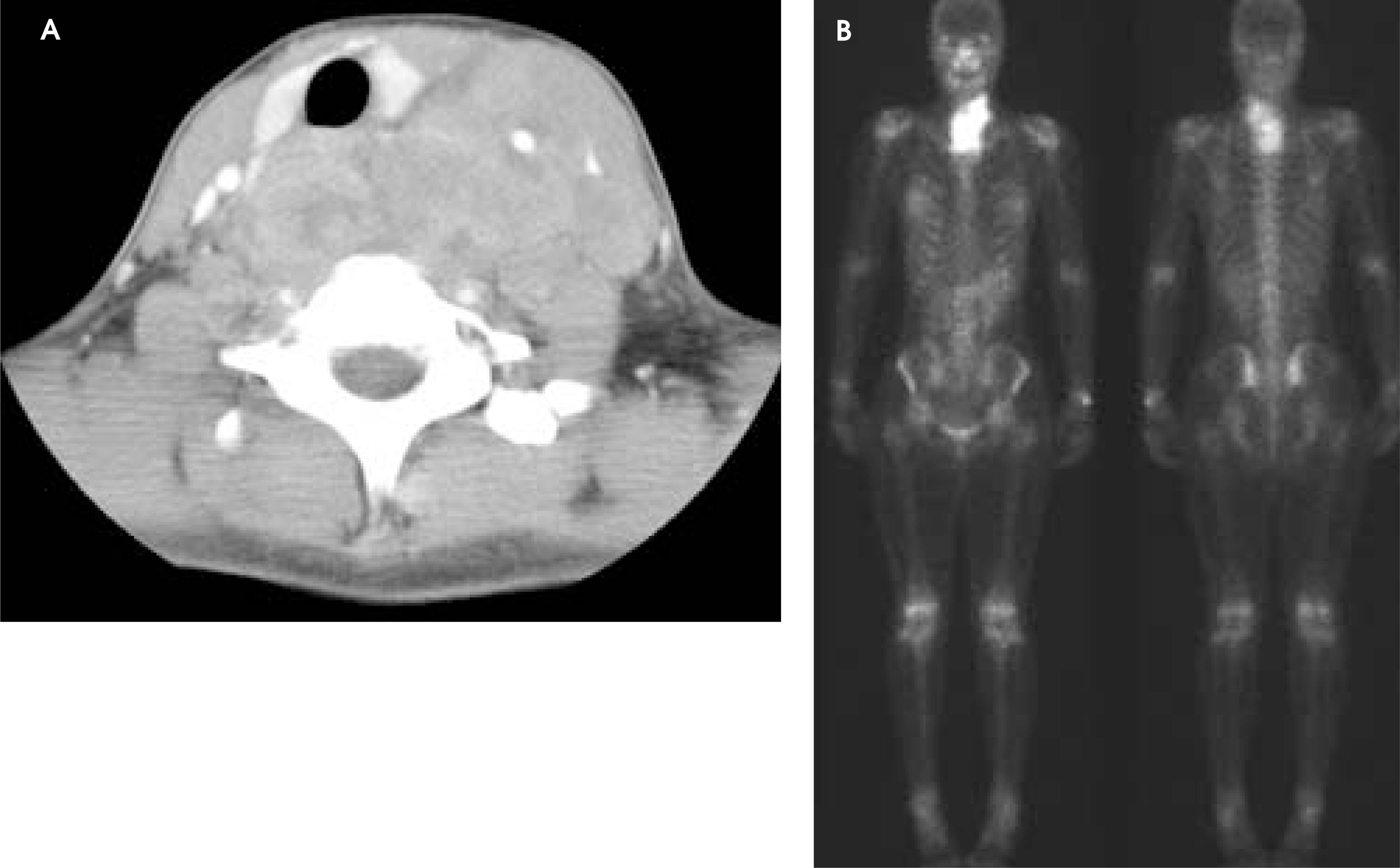 FIGURE 22.