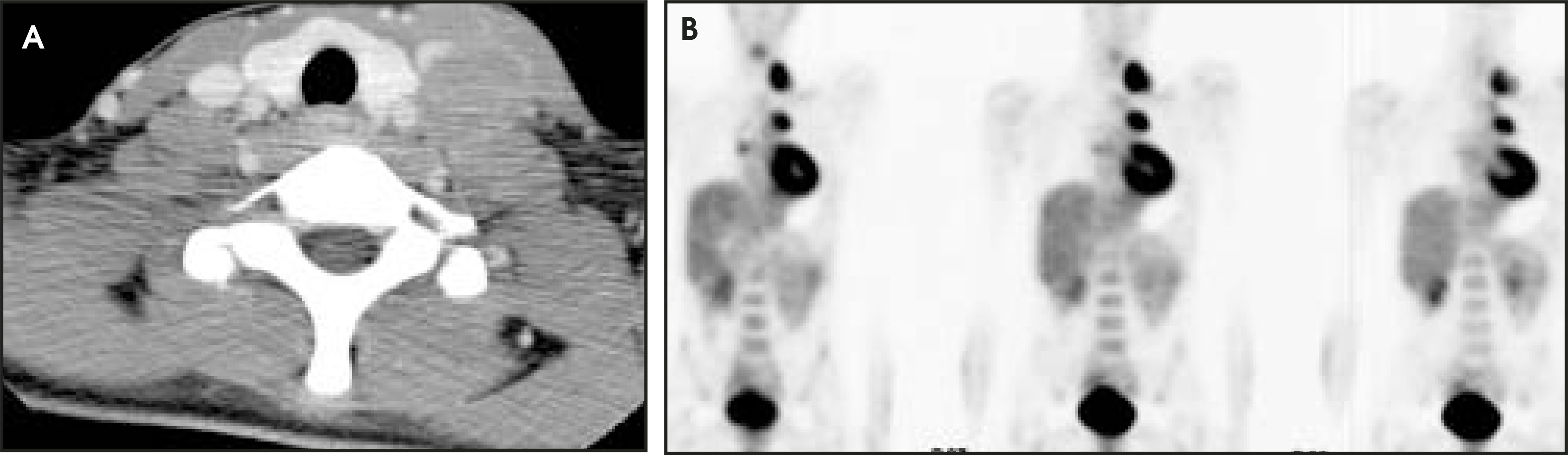 FIGURE 23.