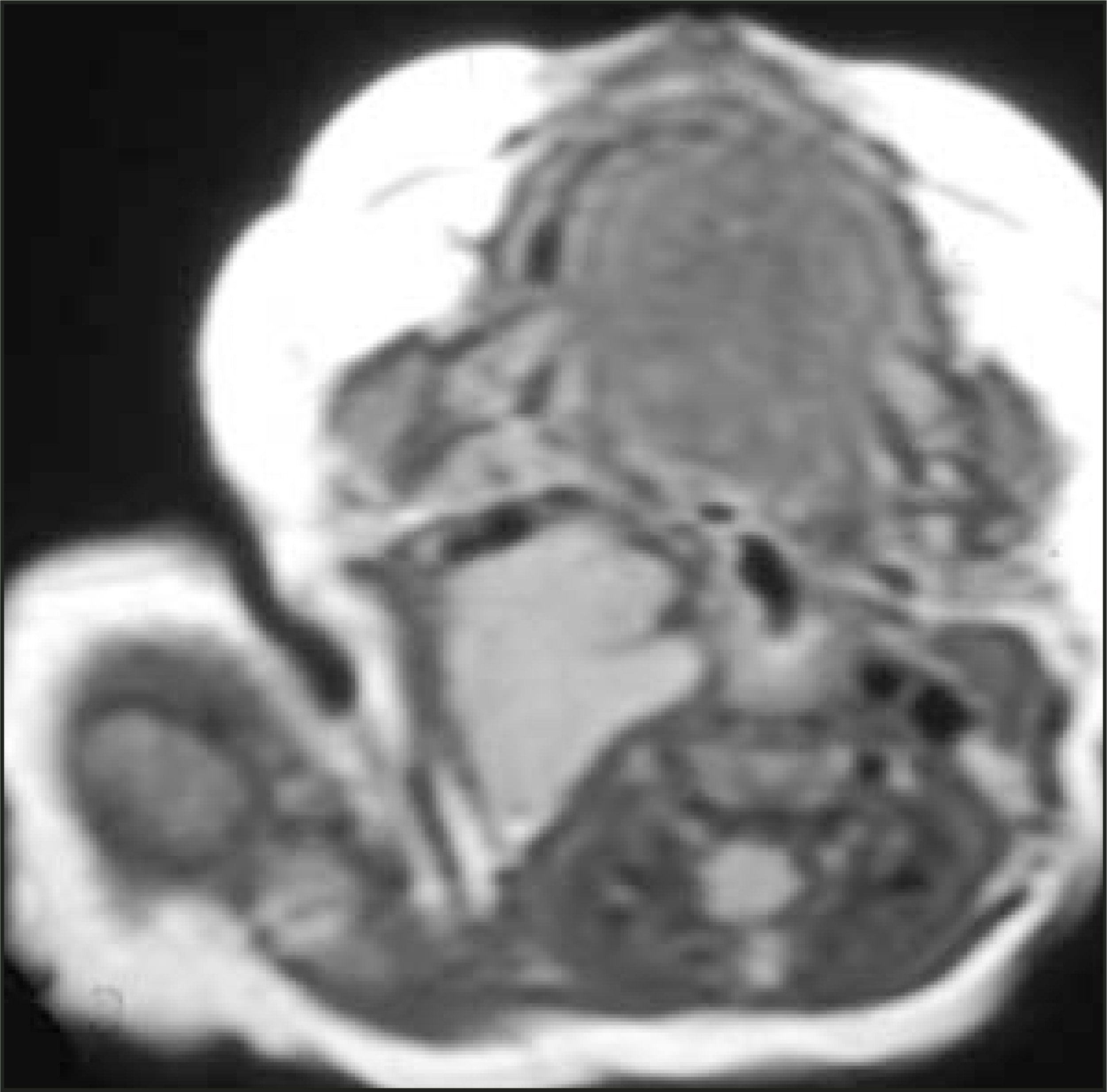 FIGURE 25.