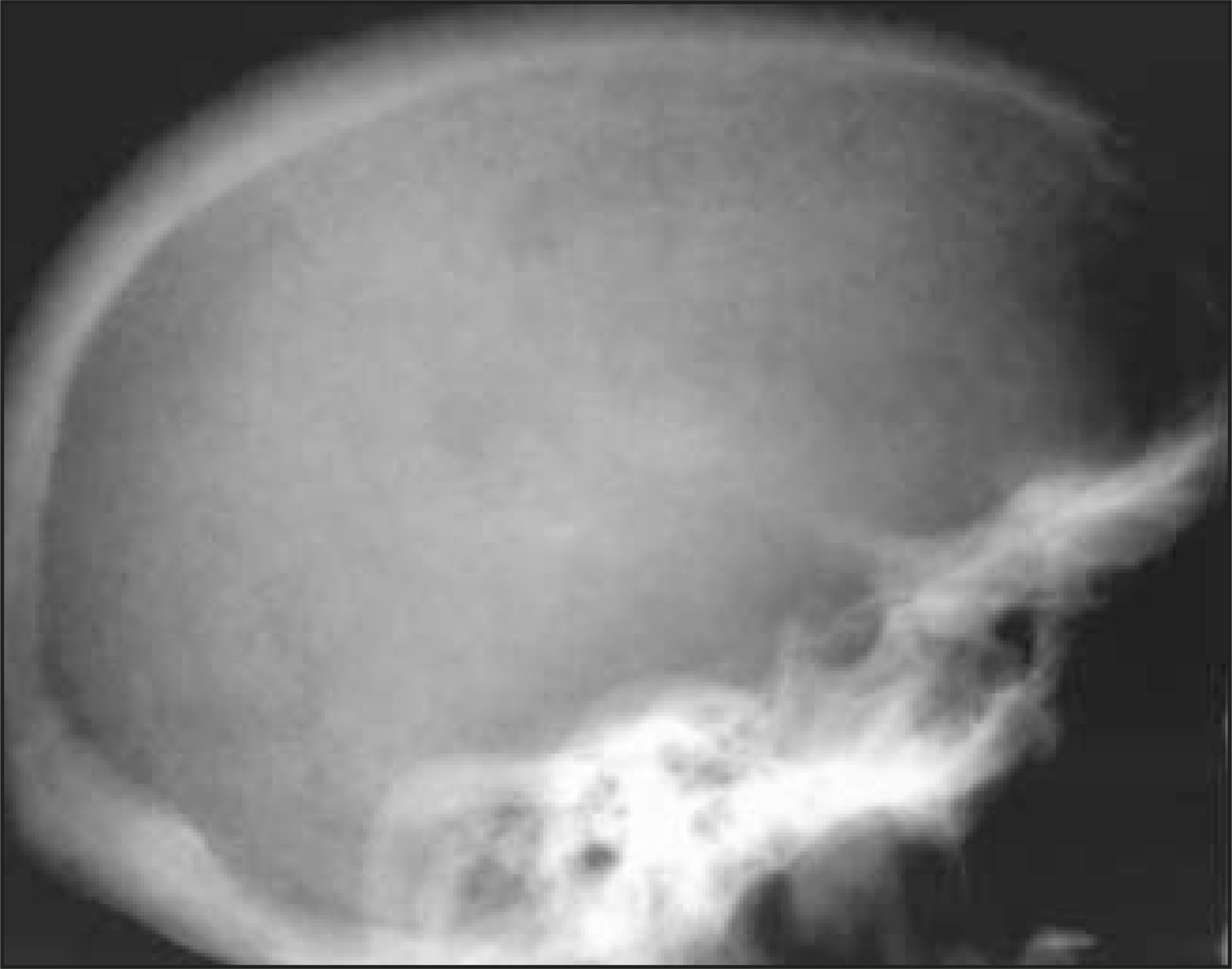 FIGURE 11.