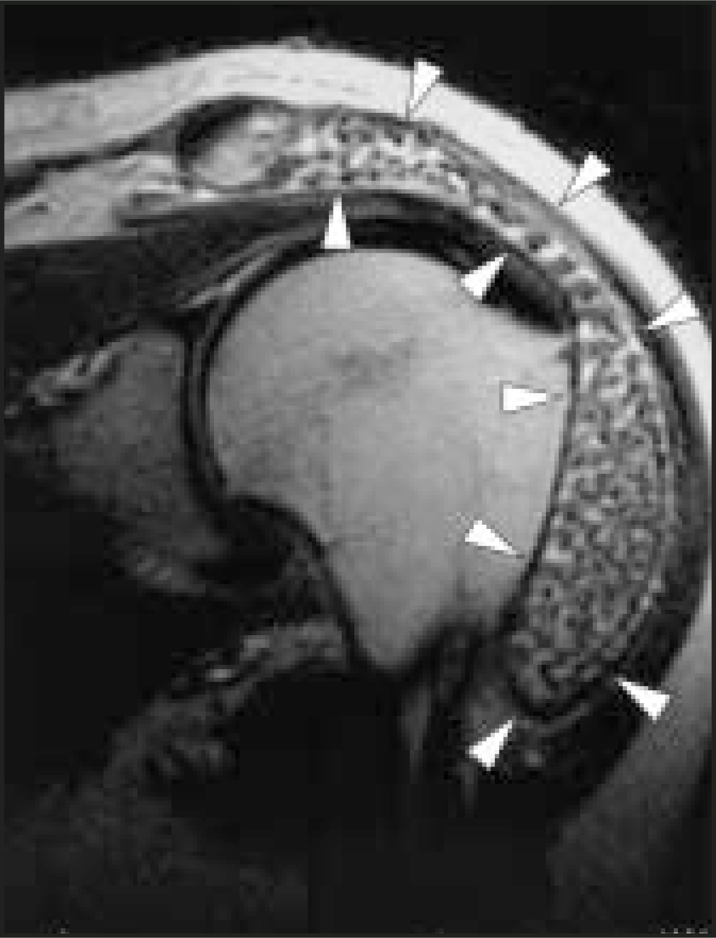 FIGURE 13.
