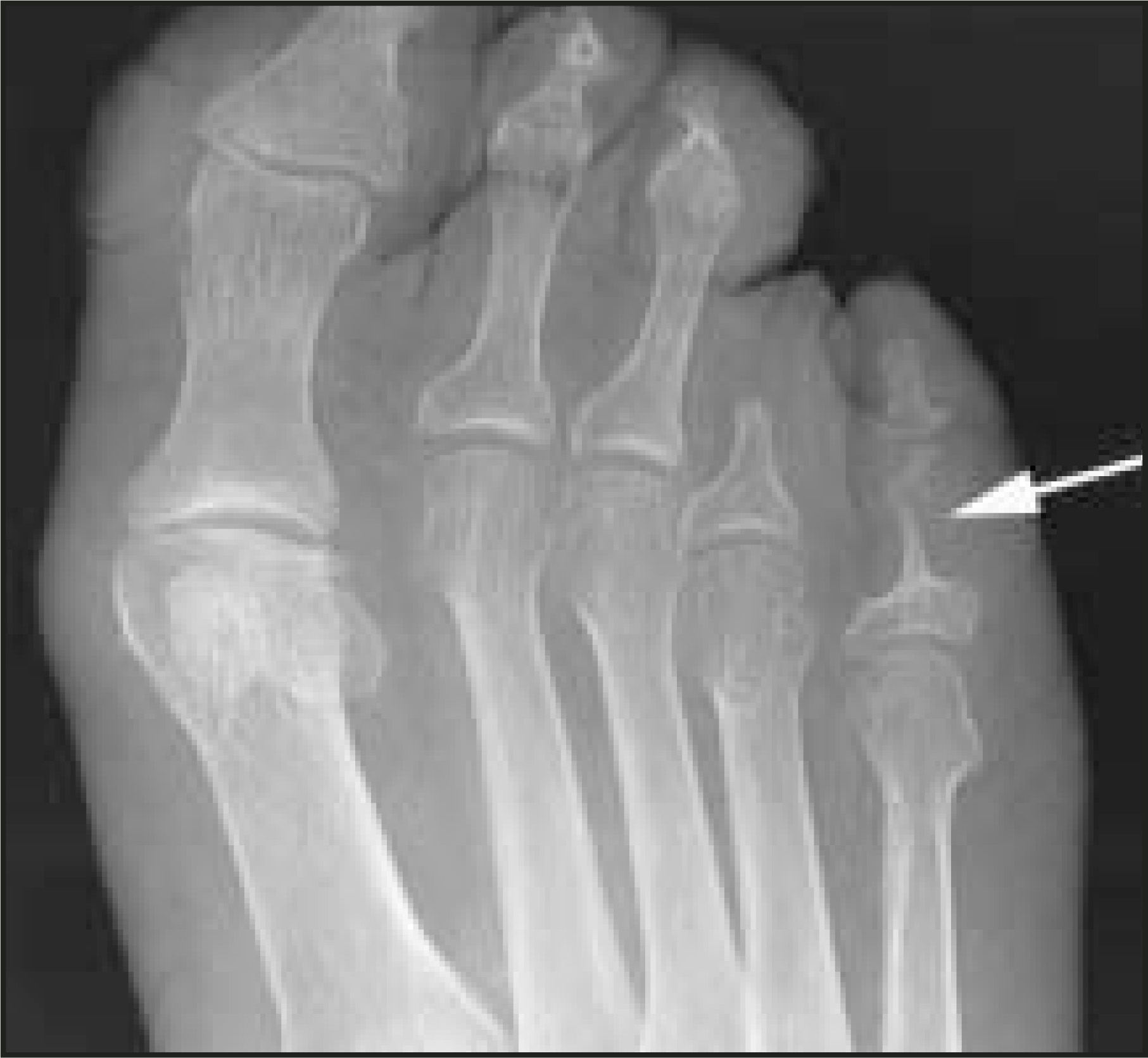 FIGURE 15.