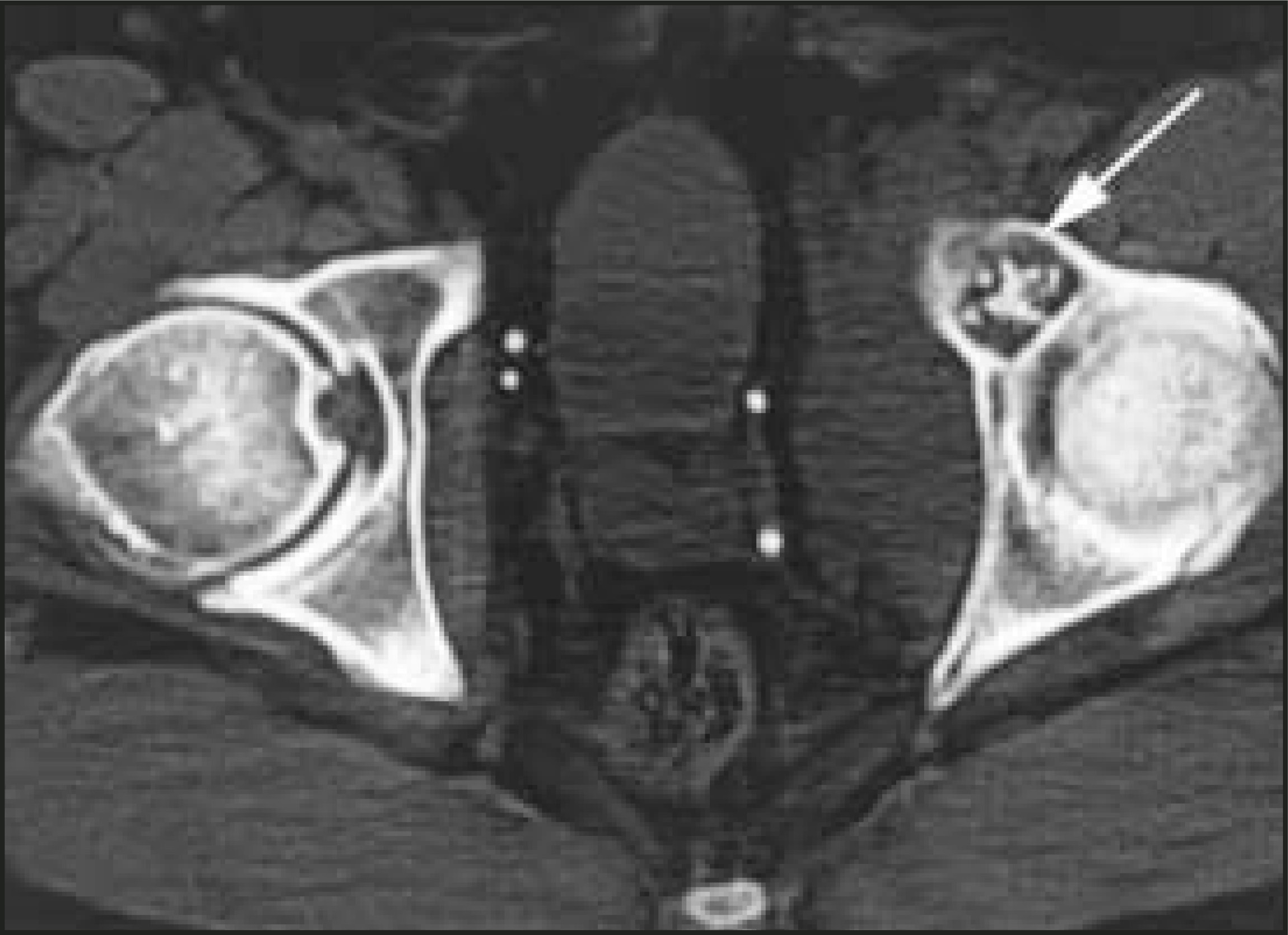 FIGURE 16.