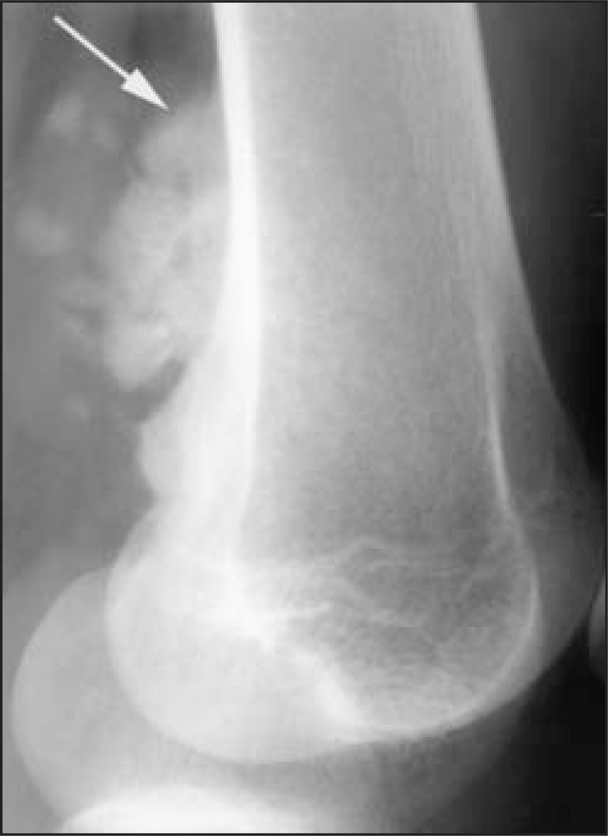 FIGURE 17.