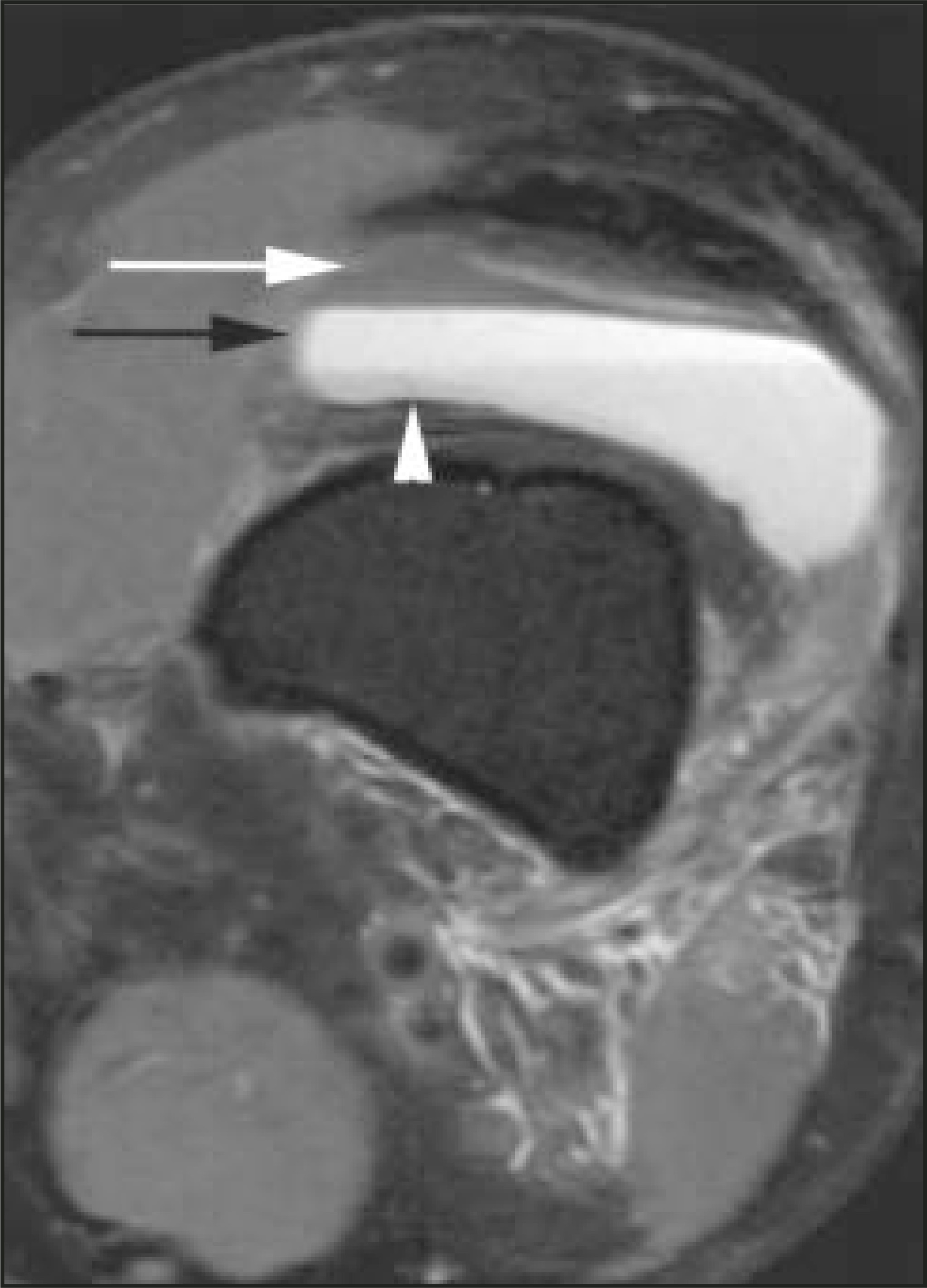 FIGURE 18.