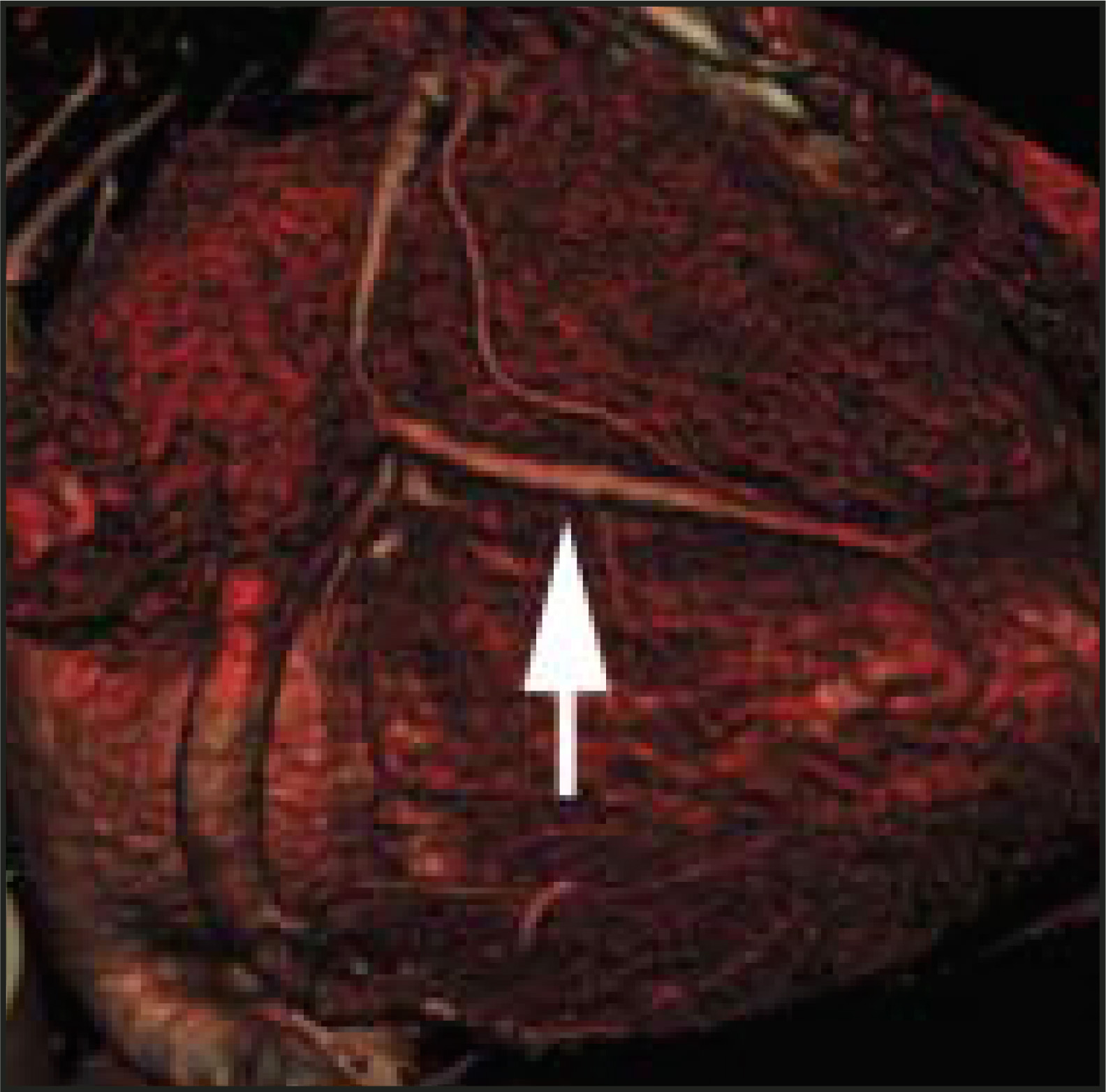 FIGURE 9.