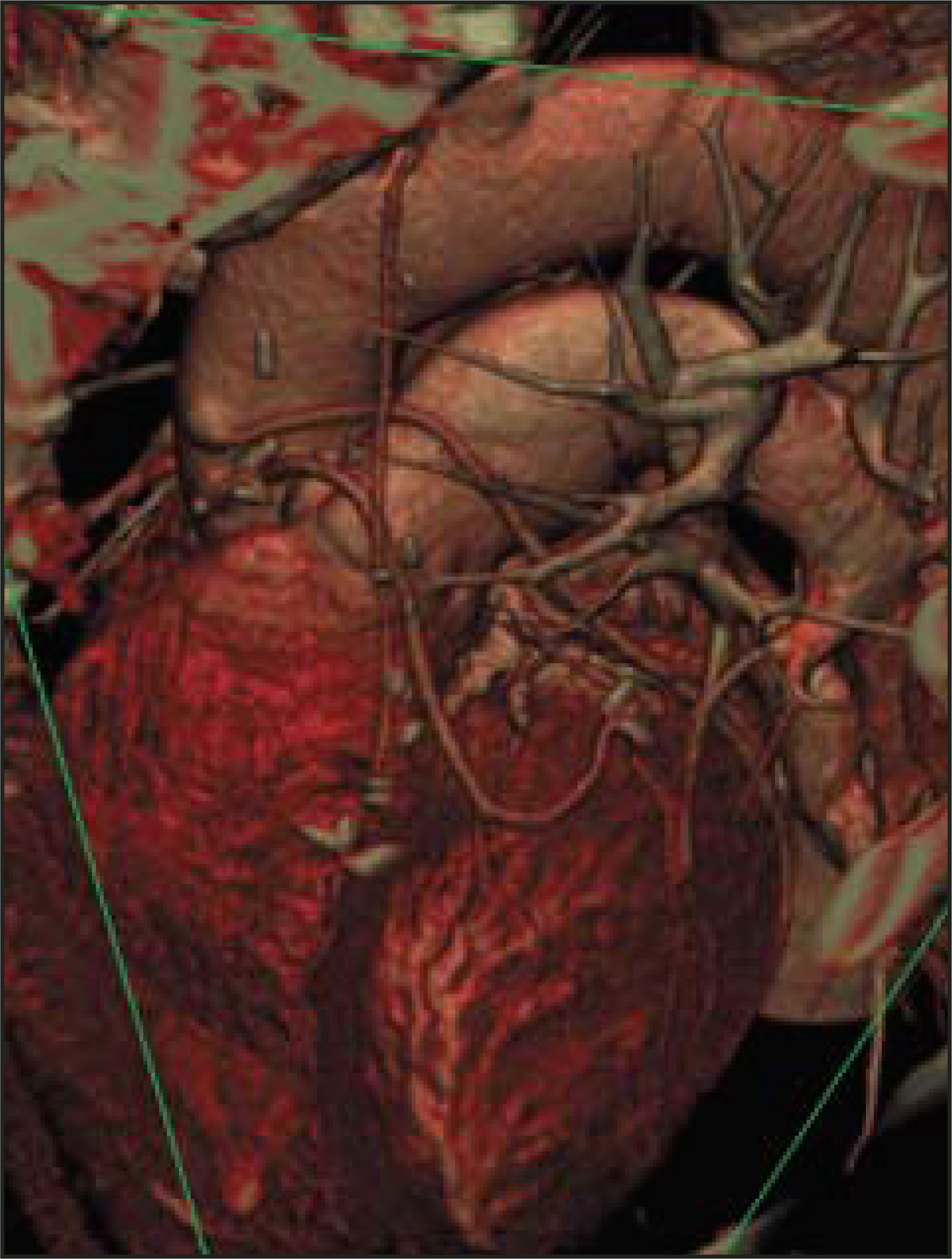 FIGURE 10.