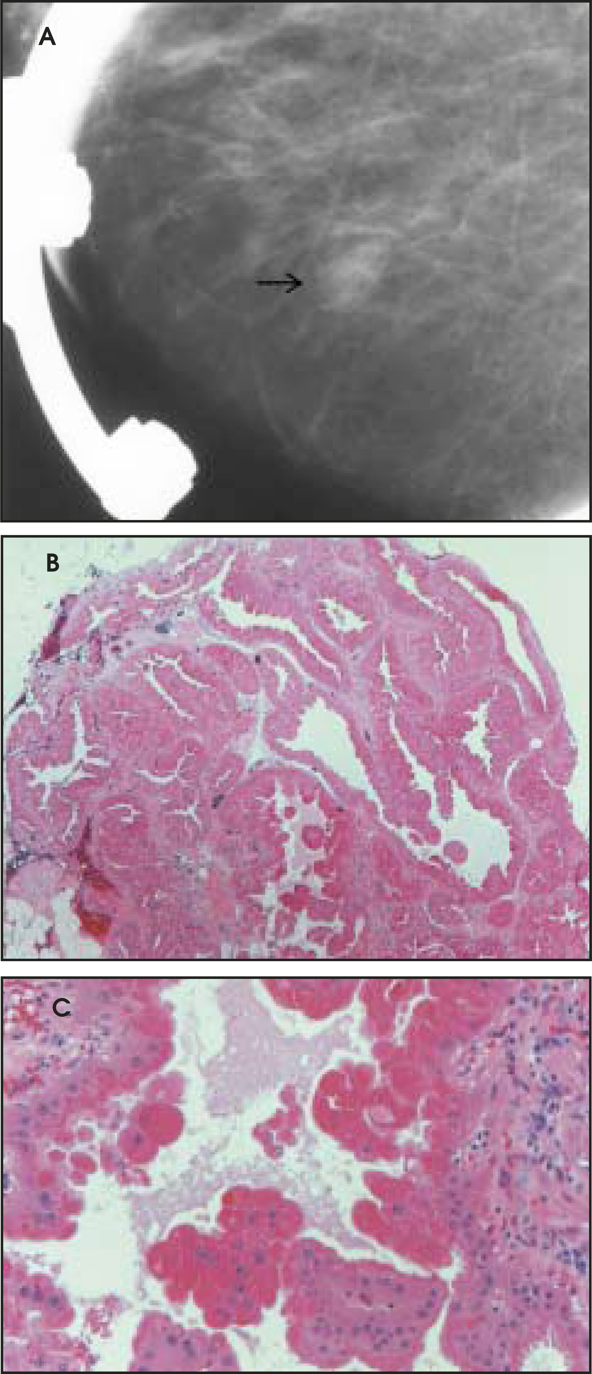 FIGURE 11.