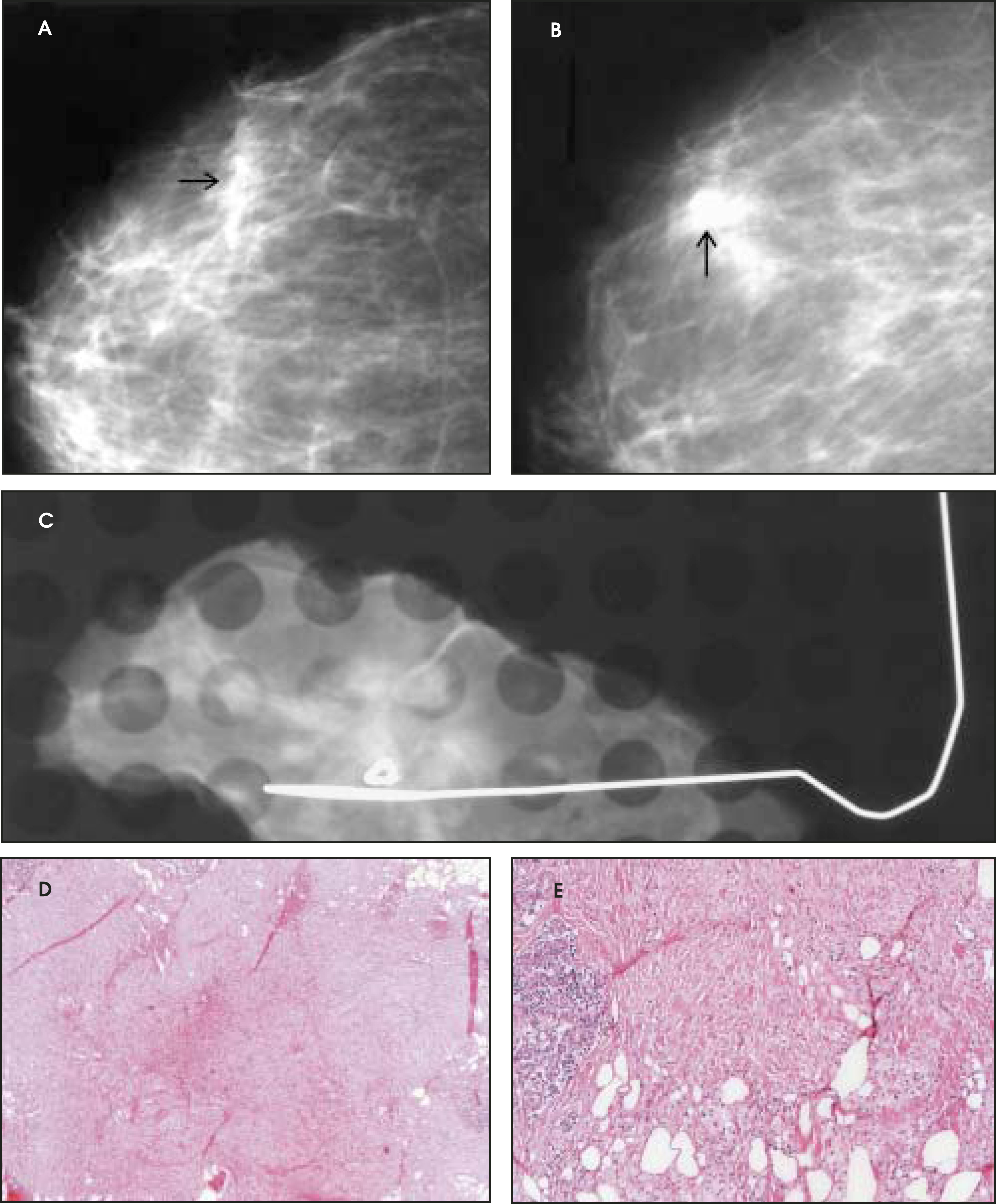 FIGURE 18.