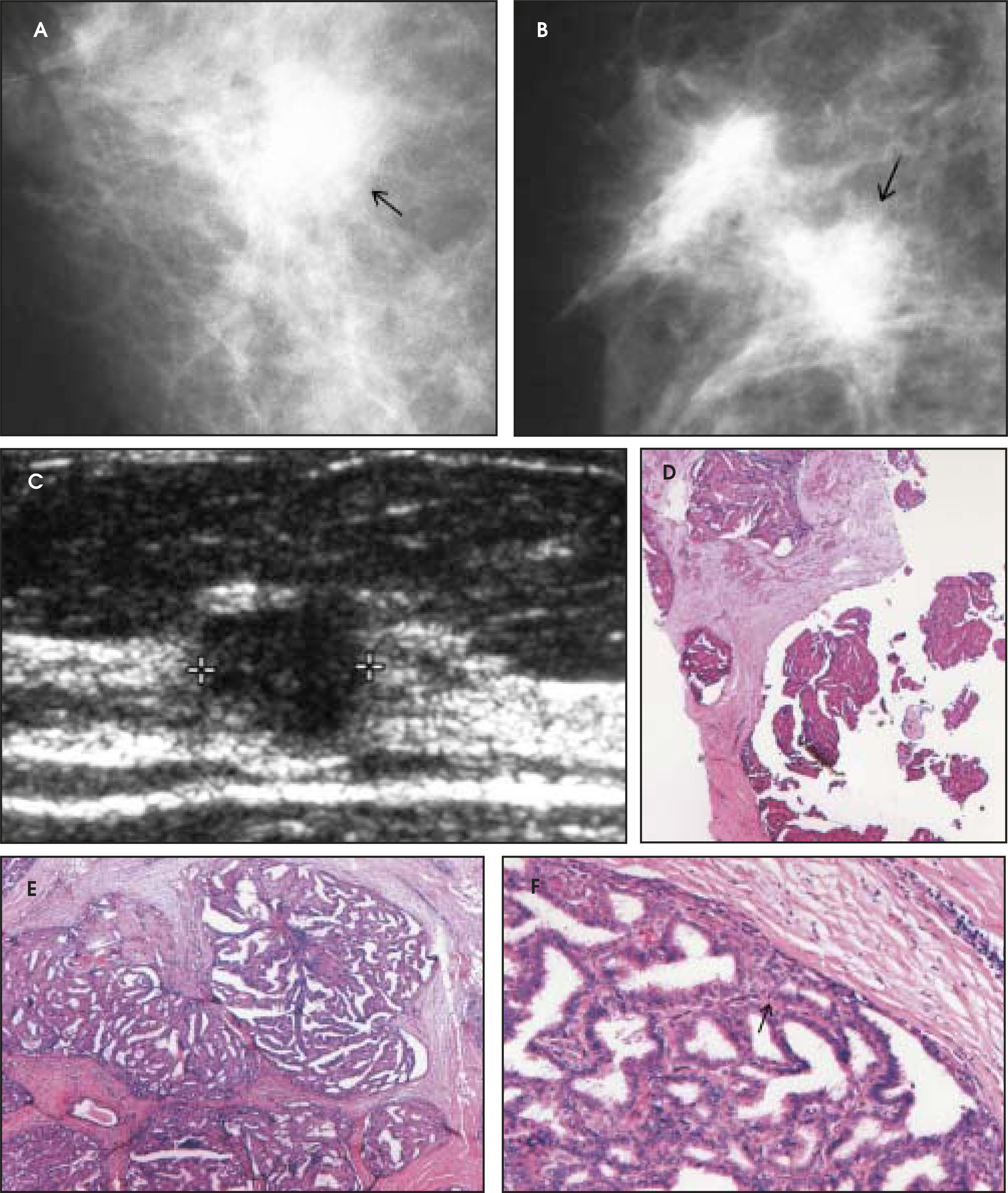 FIGURE 23.