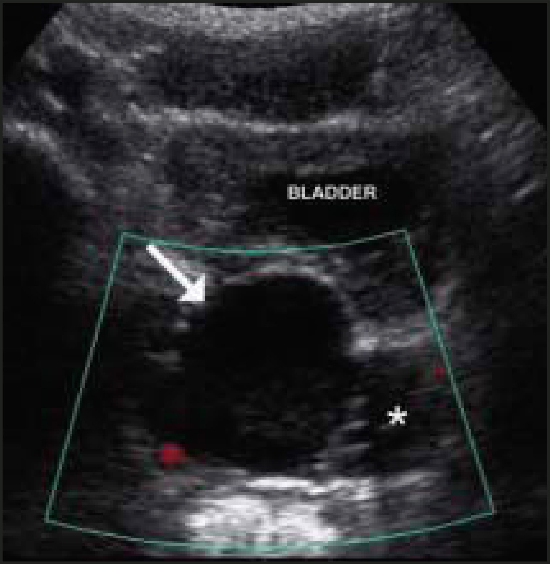 FIGURE 2.