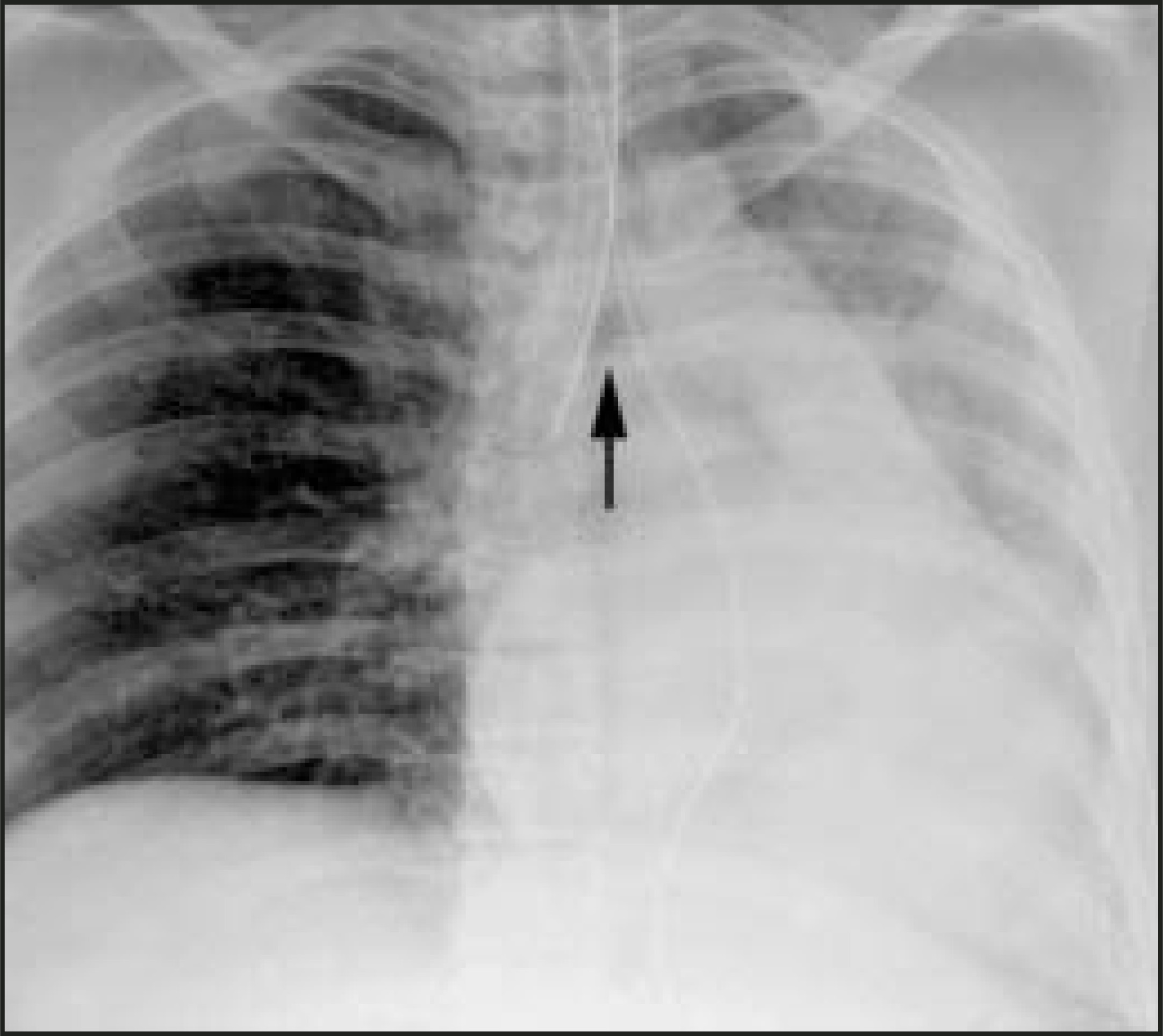 FIGURE 9.