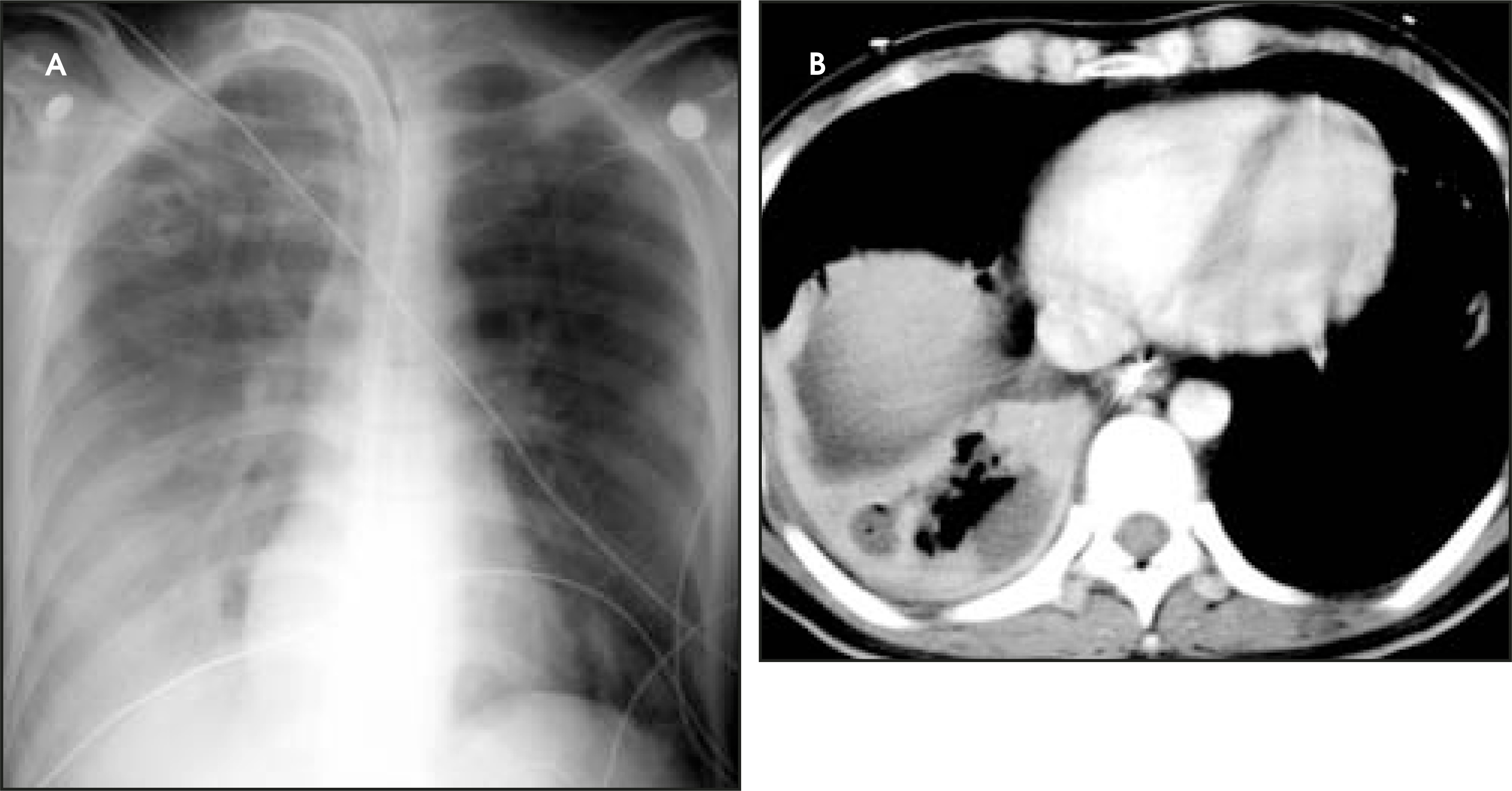 FIGURE 11.