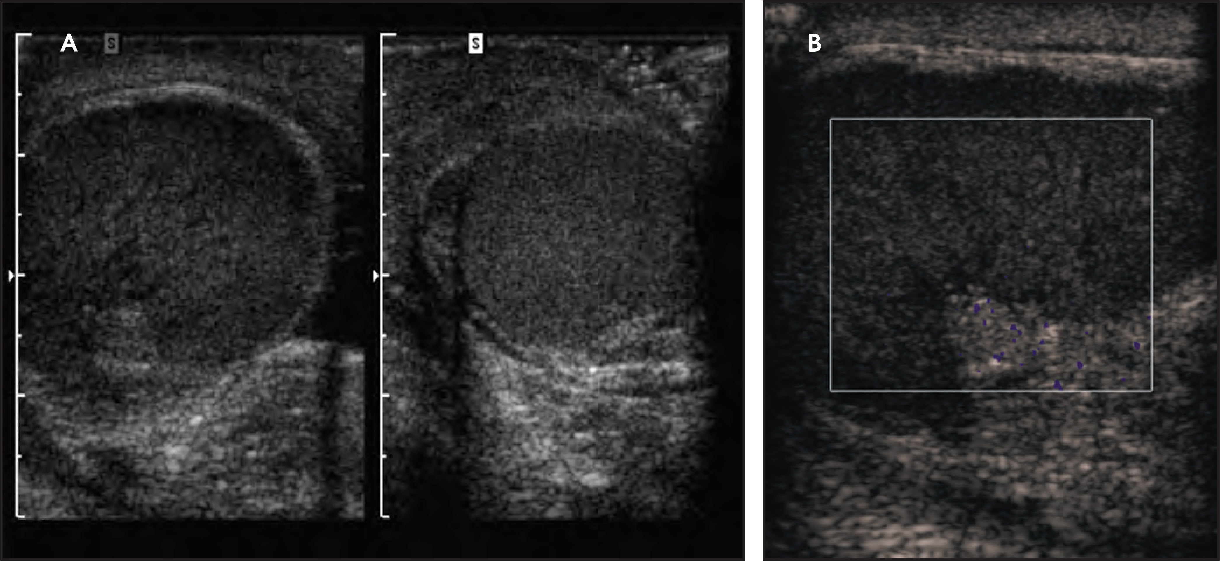 FIGURE 4.