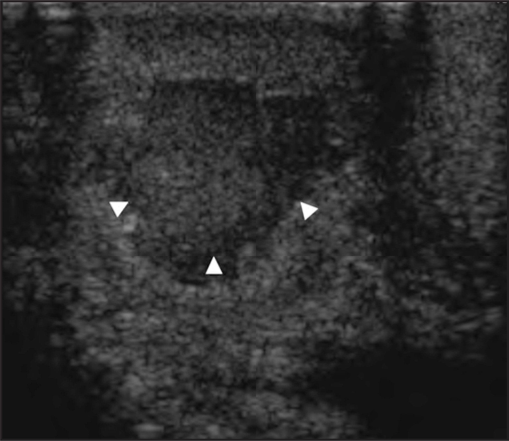 FIGURE 11.