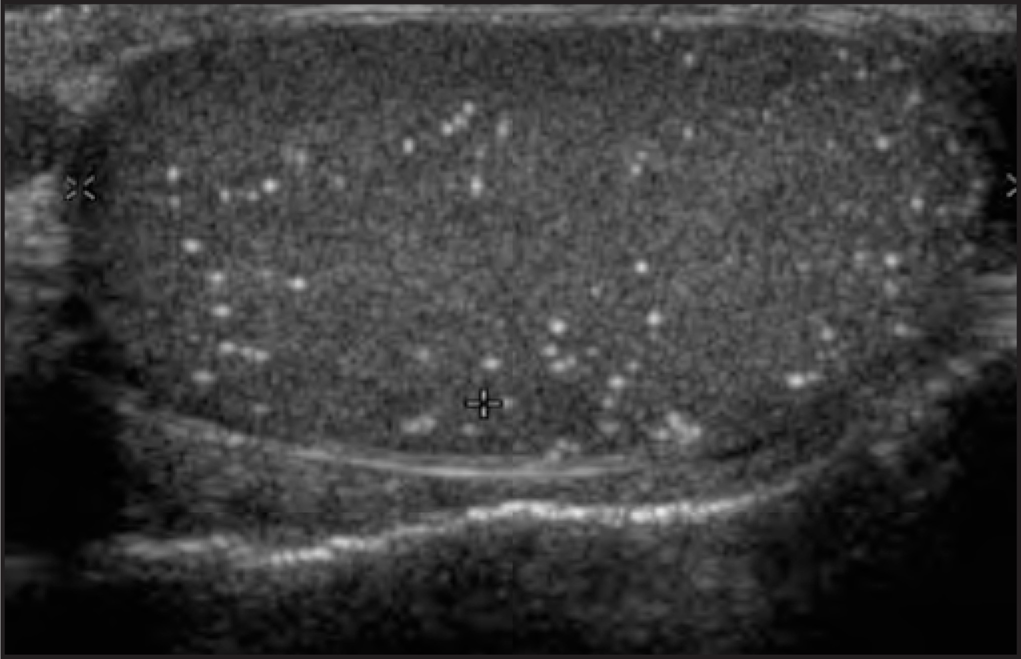 FIGURE 13.